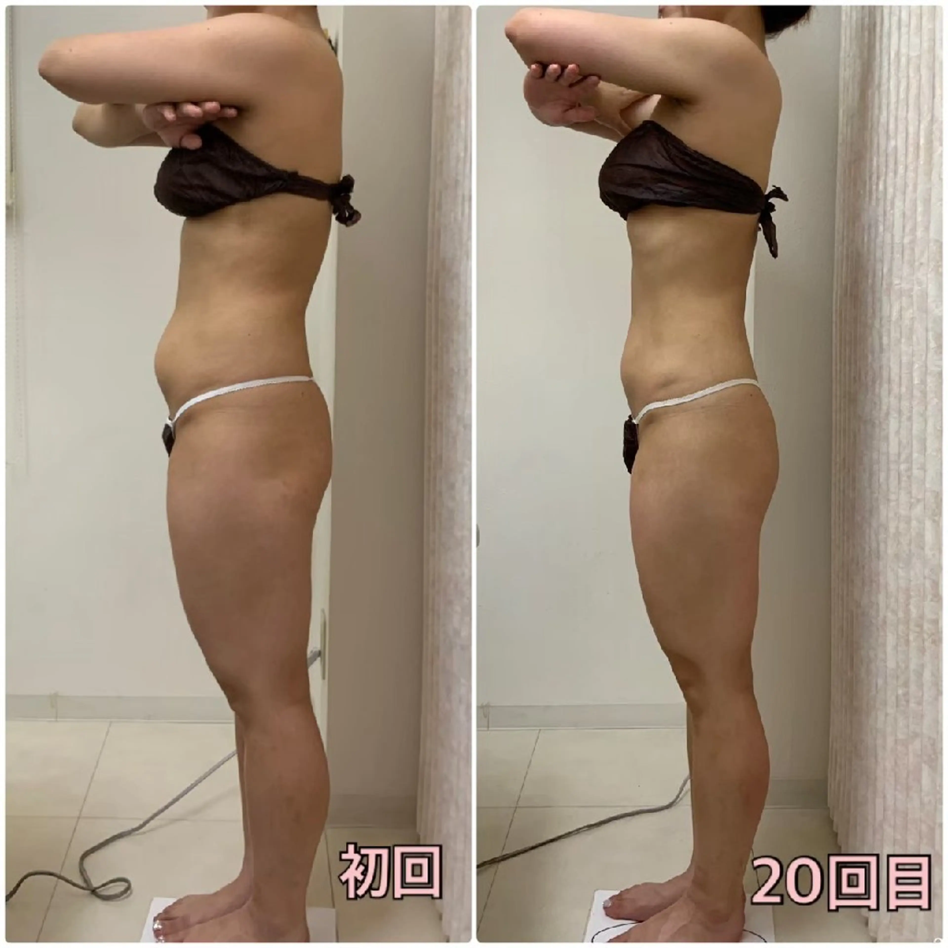 【本気痩せ希望の方◎】全身90分×２回¥9,900脂肪・セル撃退/骨格＆姿勢矯正の写真