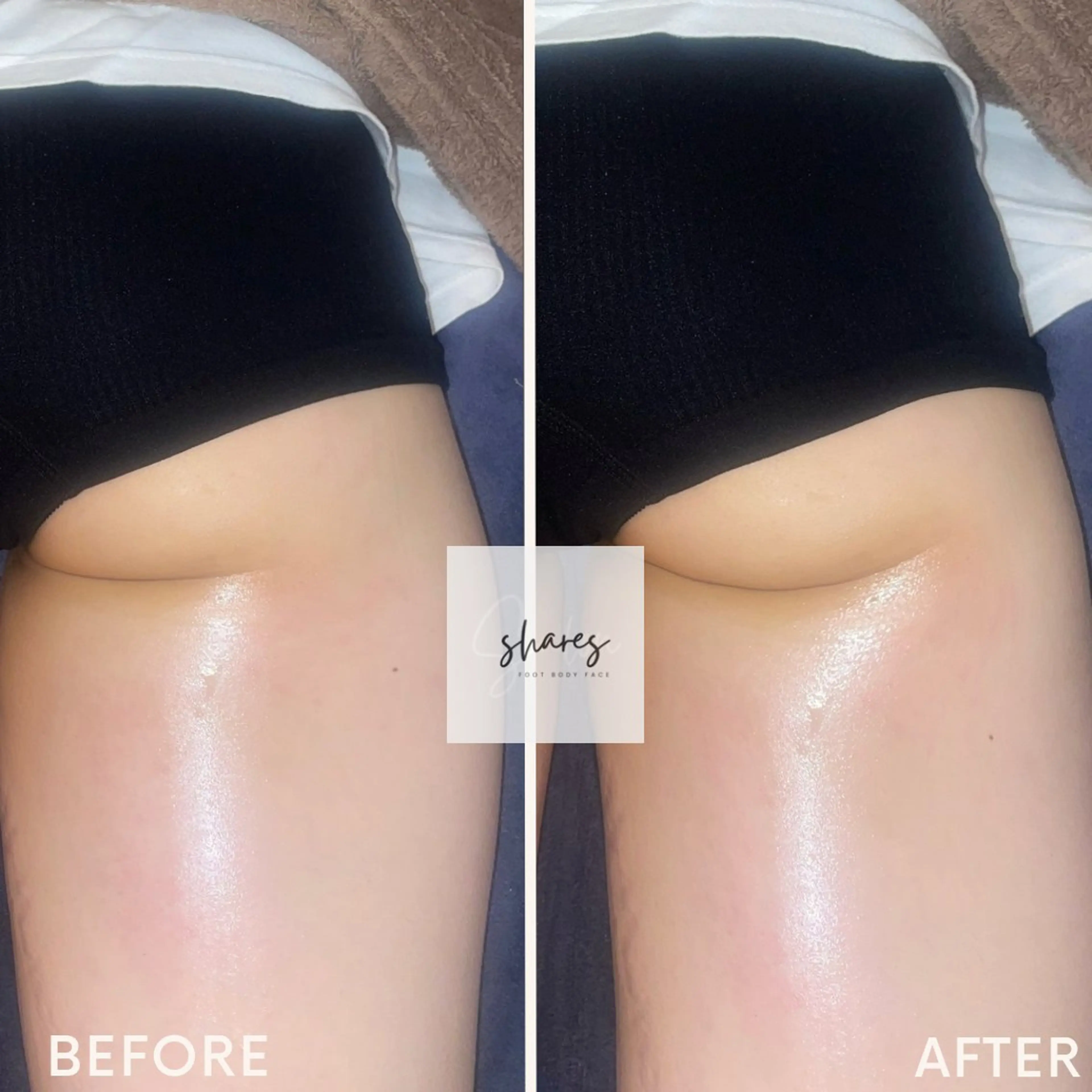 SHARES MADOKAのエステ・リラクイメージ