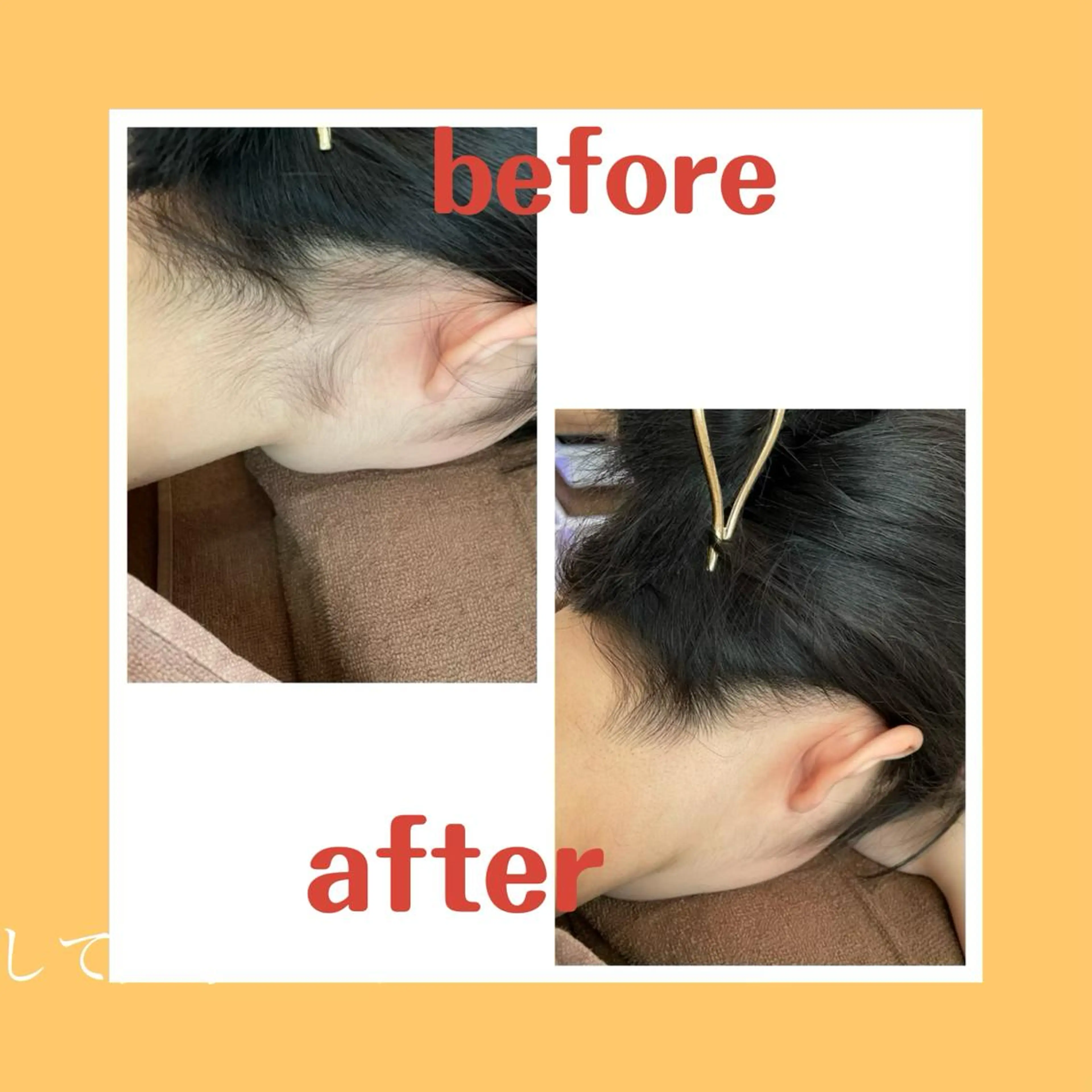 脱毛 salonde ReGodのエステ・リラクイメージ