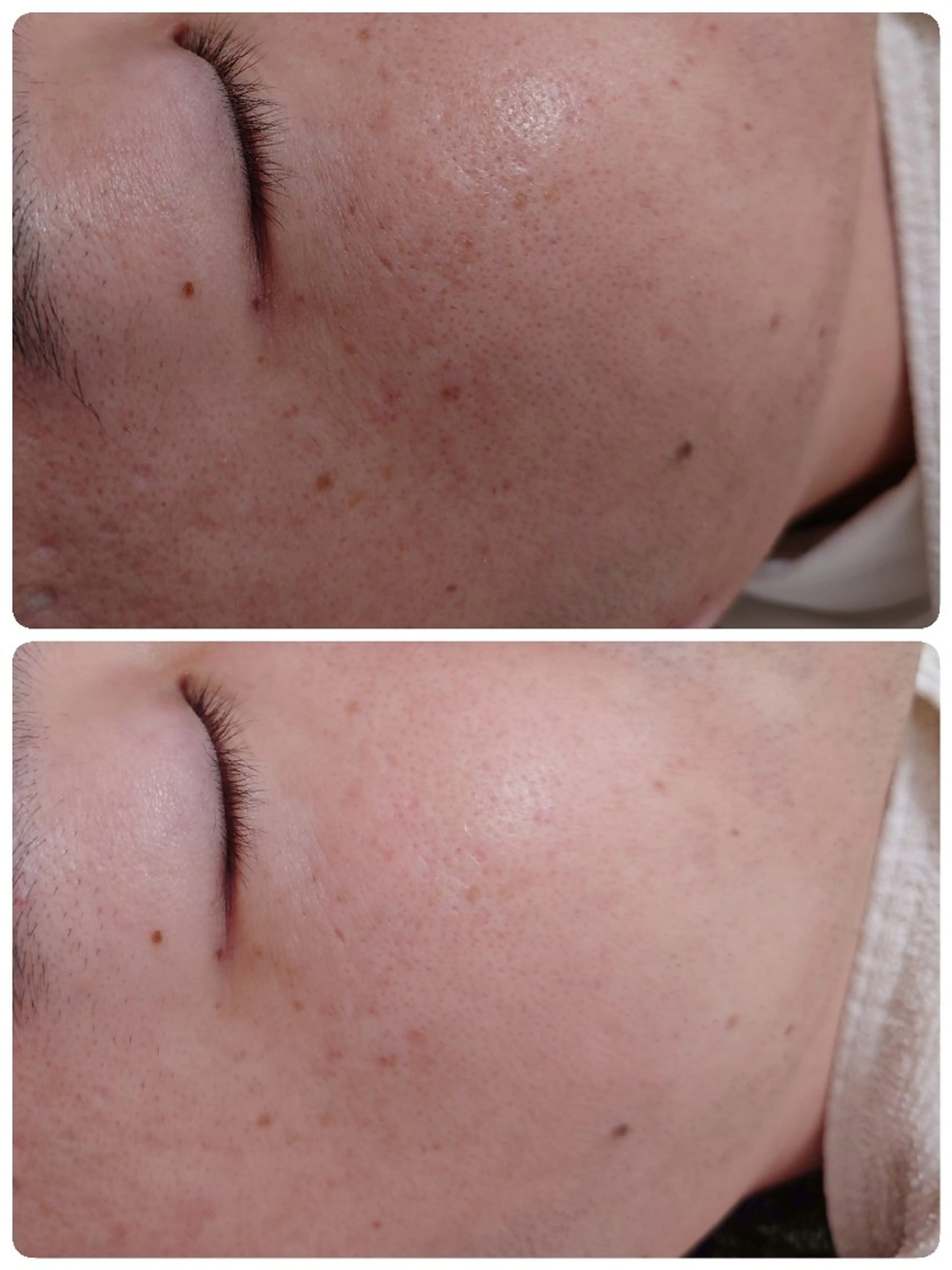 エステ Abe Yukaのエステ・リラクイメージ