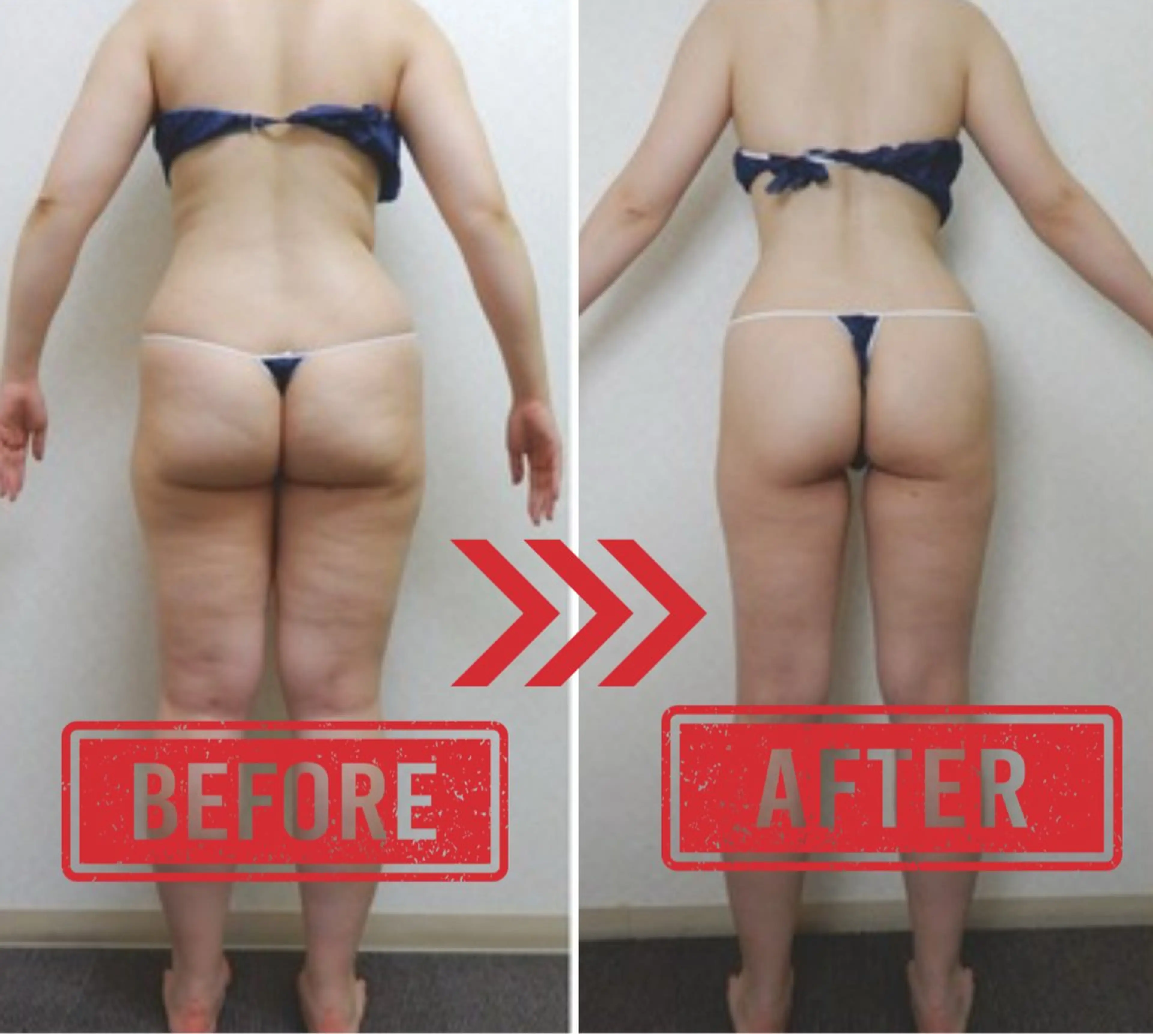 女性のお悩みボディーケアコースの写真