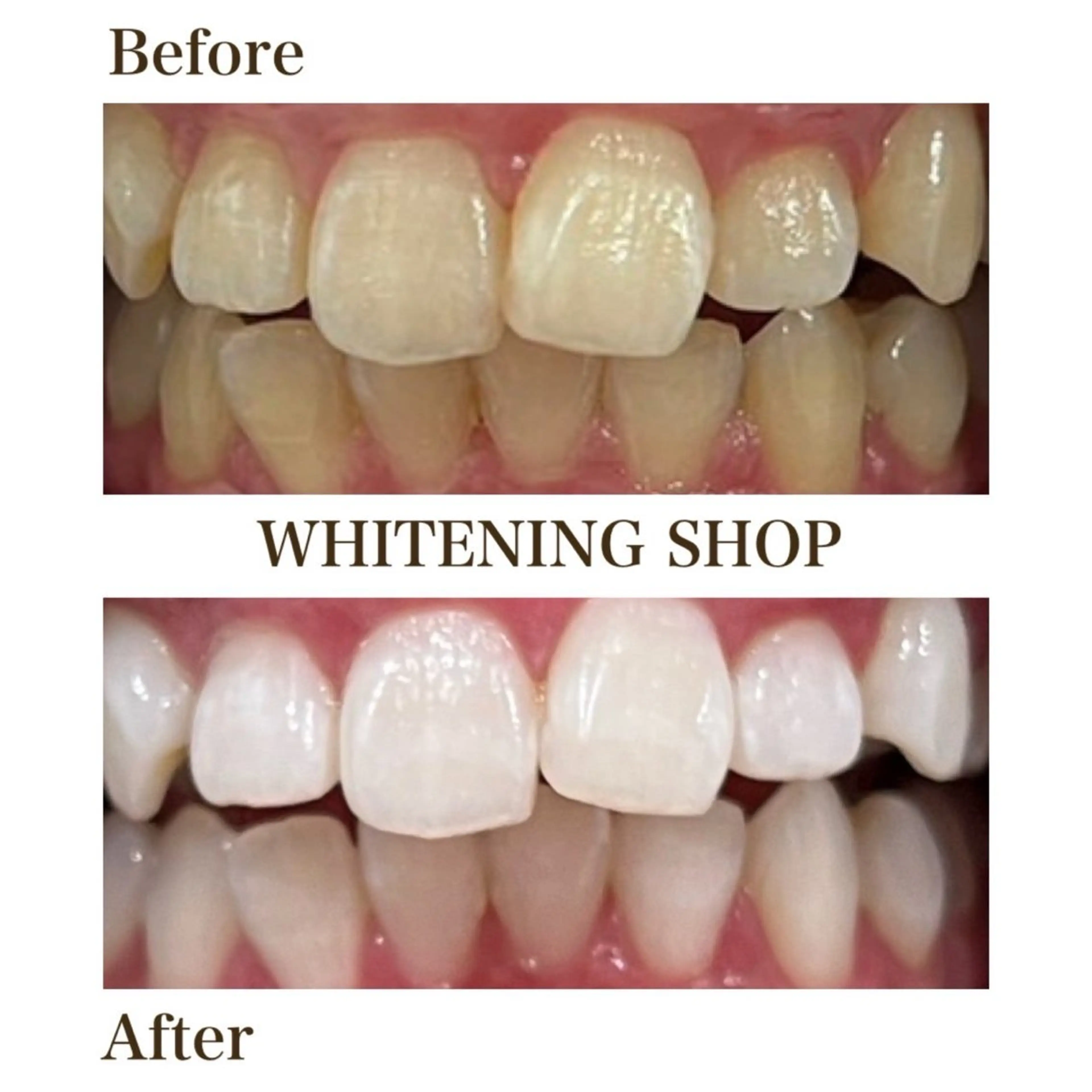 メンズ ホワイトニングショップ静岡葵区店所属・ホワイトニング ショップ葵区静岡駅店のその他イメージ