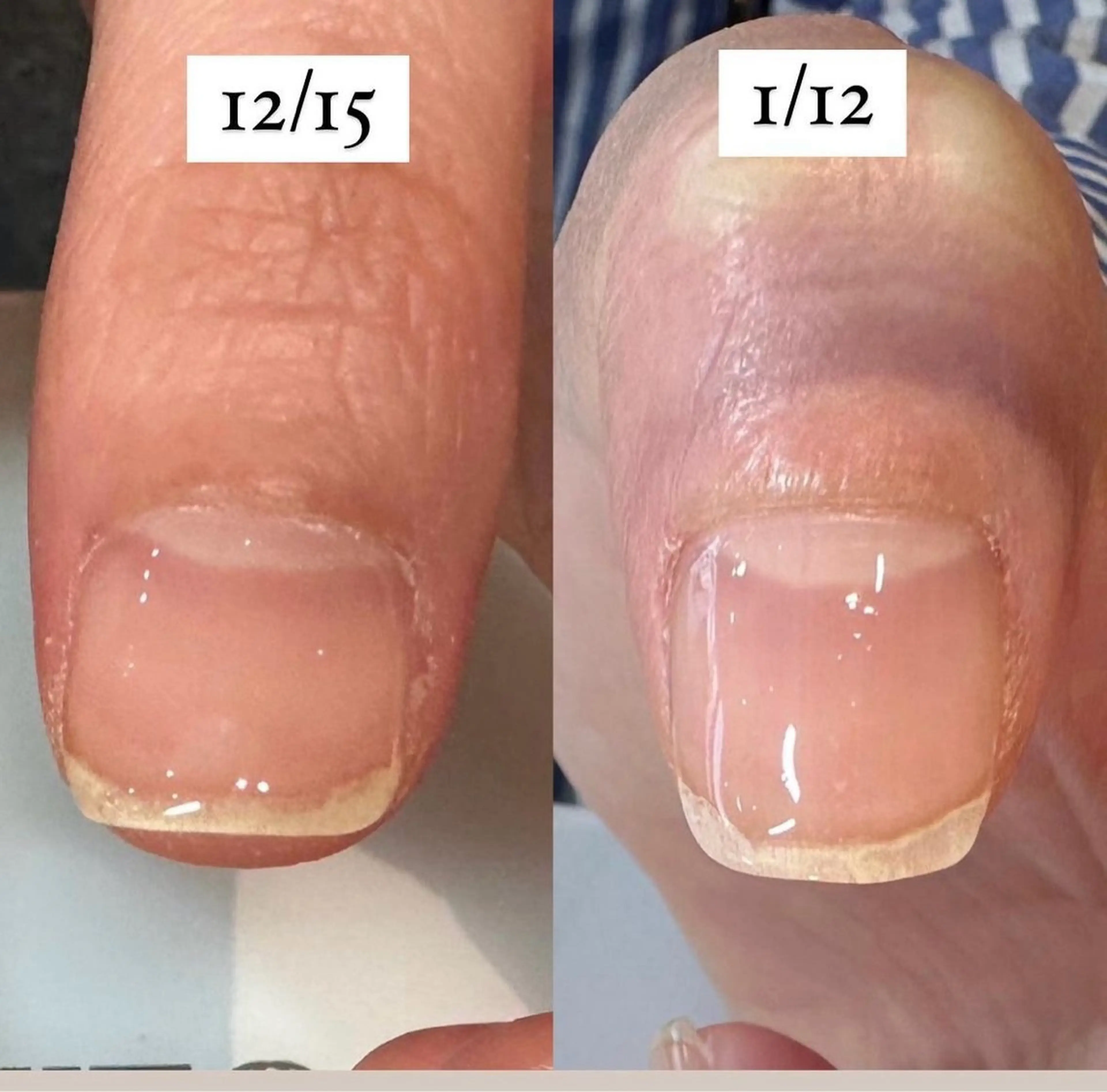 オフ／フィルインなし★美爪育成ルミナジェルクリア　ツヤ有・無選べます6600円の写真