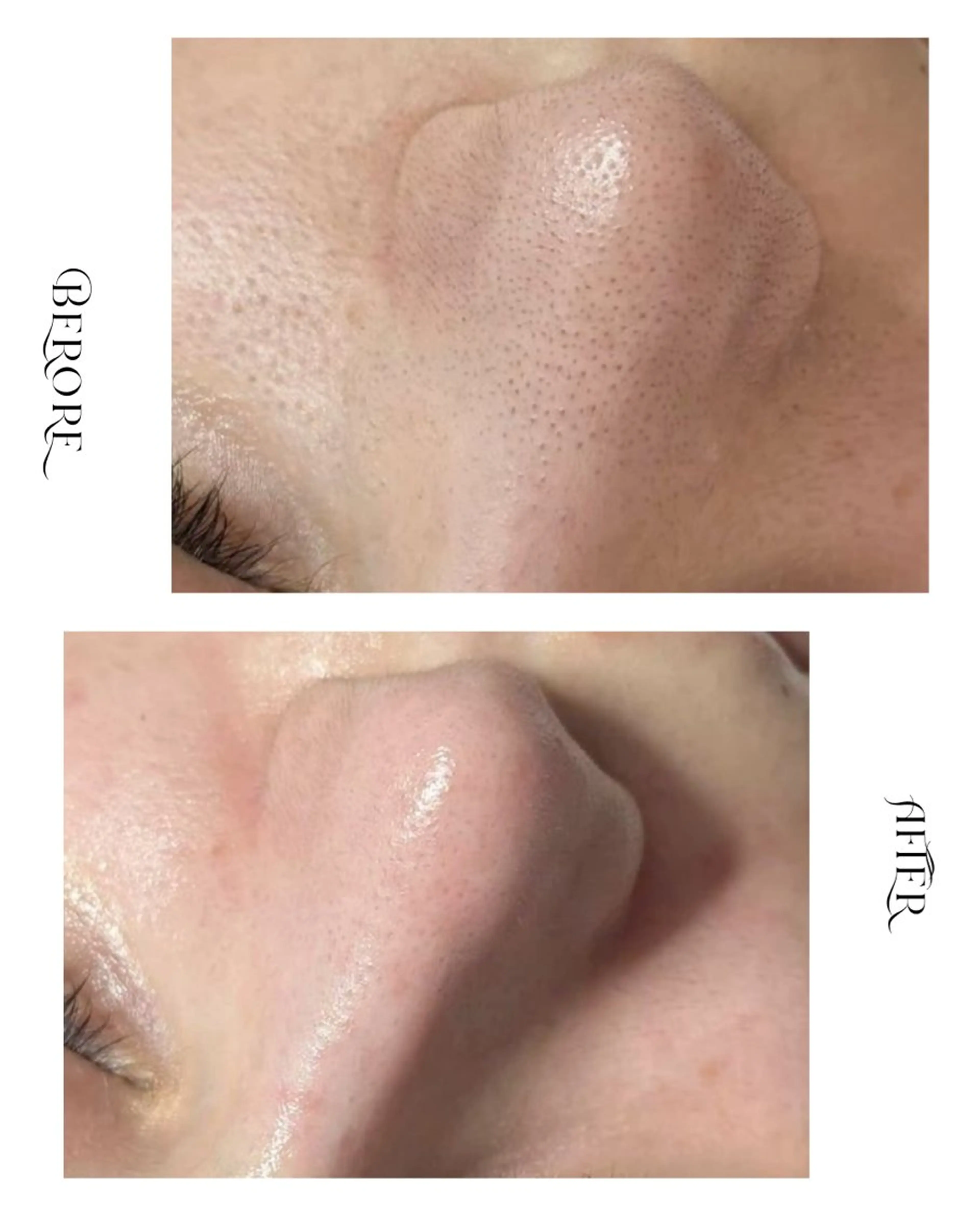 脱毛・肌質改善サロン Linoのエステ・リラクイメージ