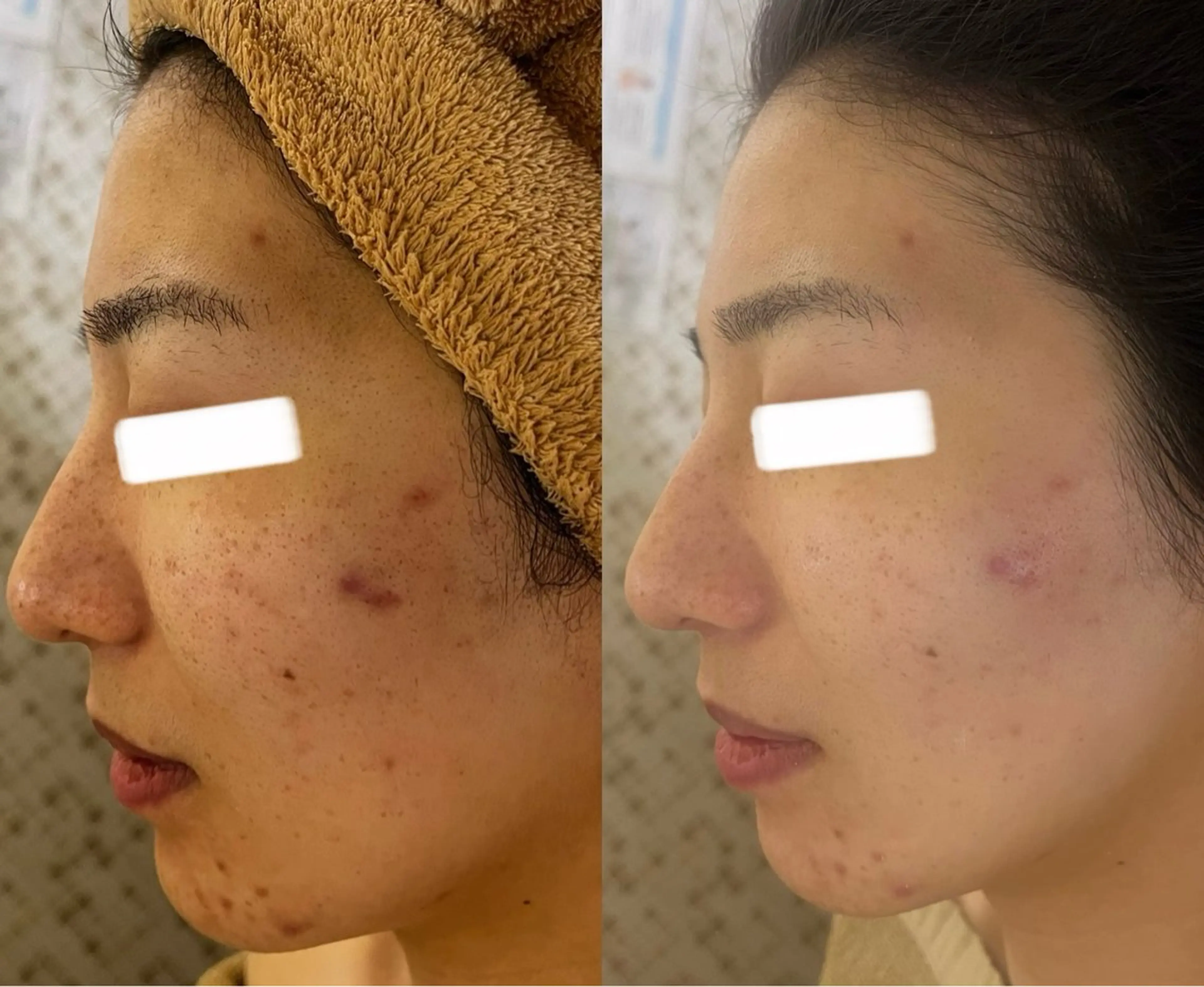 小顔&美肌品川店 Masqueradeのエステ・リラクイメージ