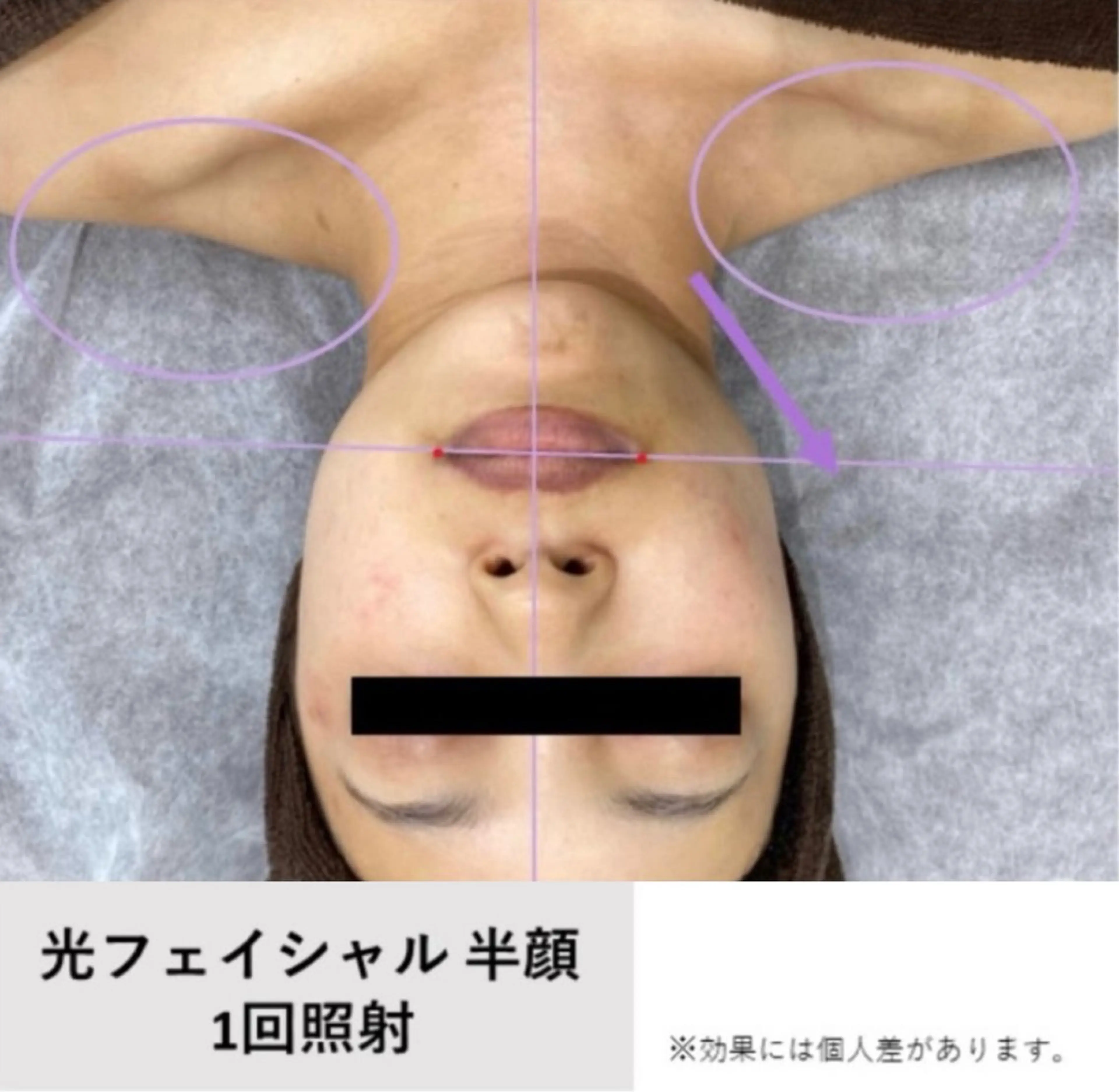 エステ Croix所属・Croix Yukaの眉毛・アイブロウイメージ