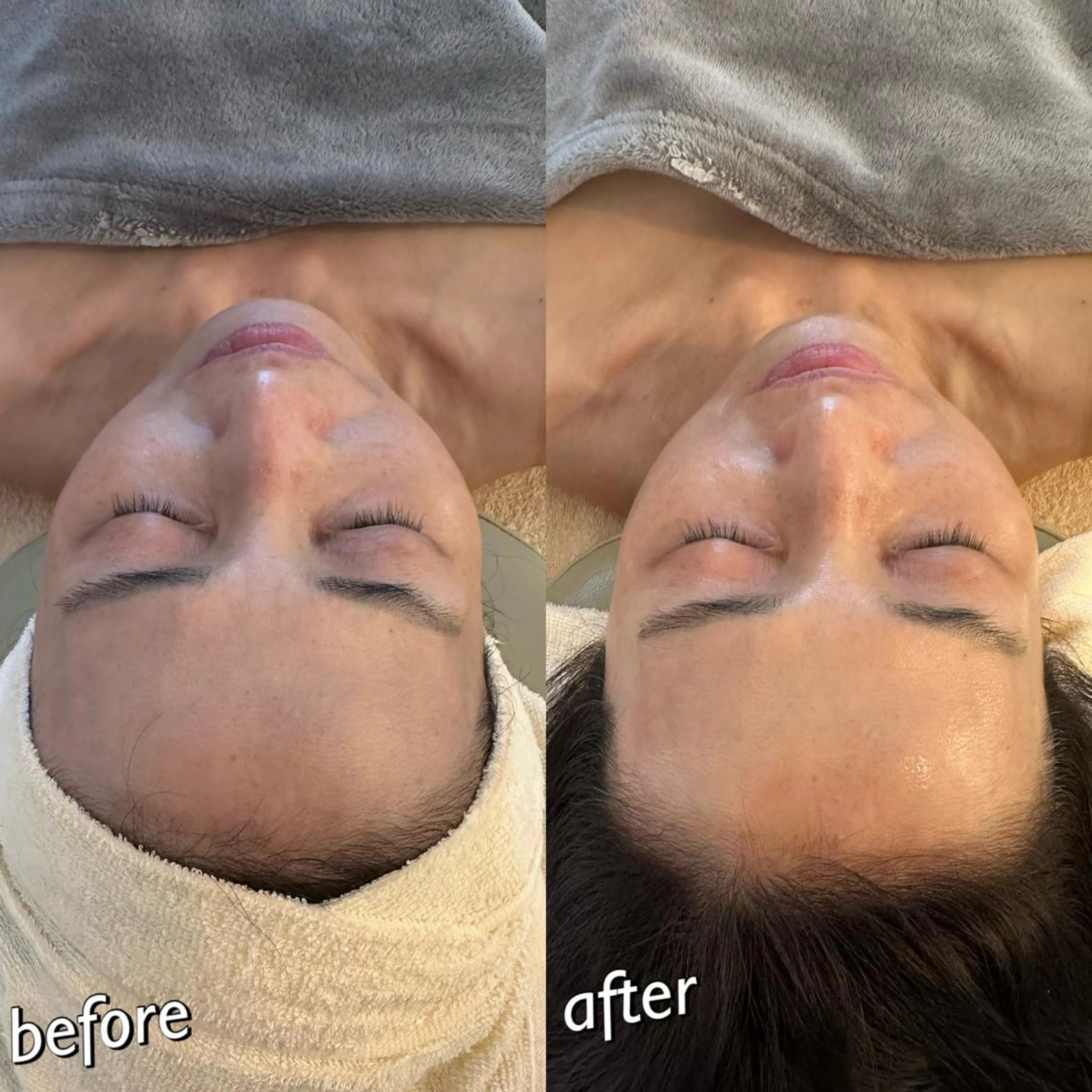 うなじ脱毛/美肌脱毛 LABELのエステ・リラクイメージ