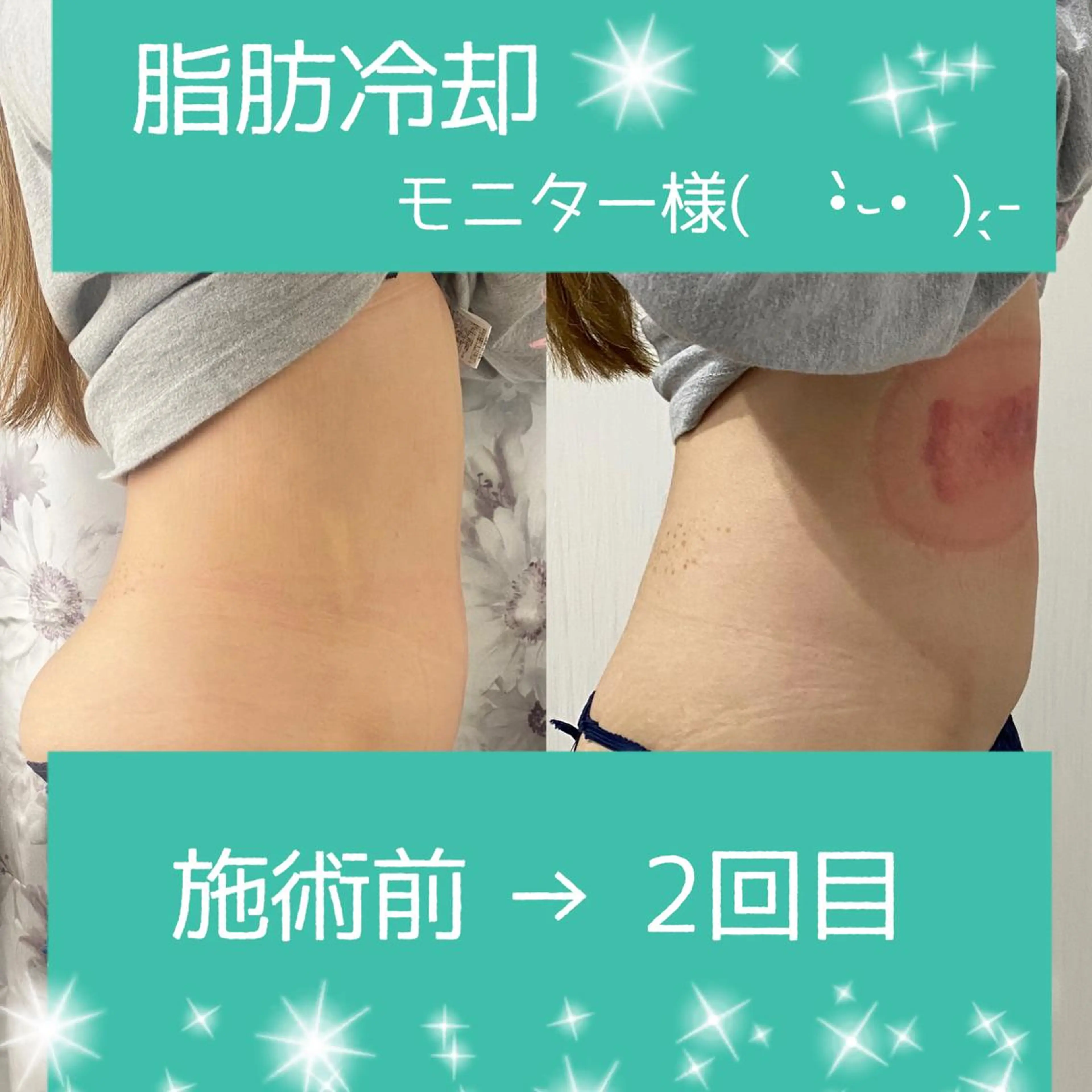 Salon💫 Lino'a柏店のエステ・リラクイメージ