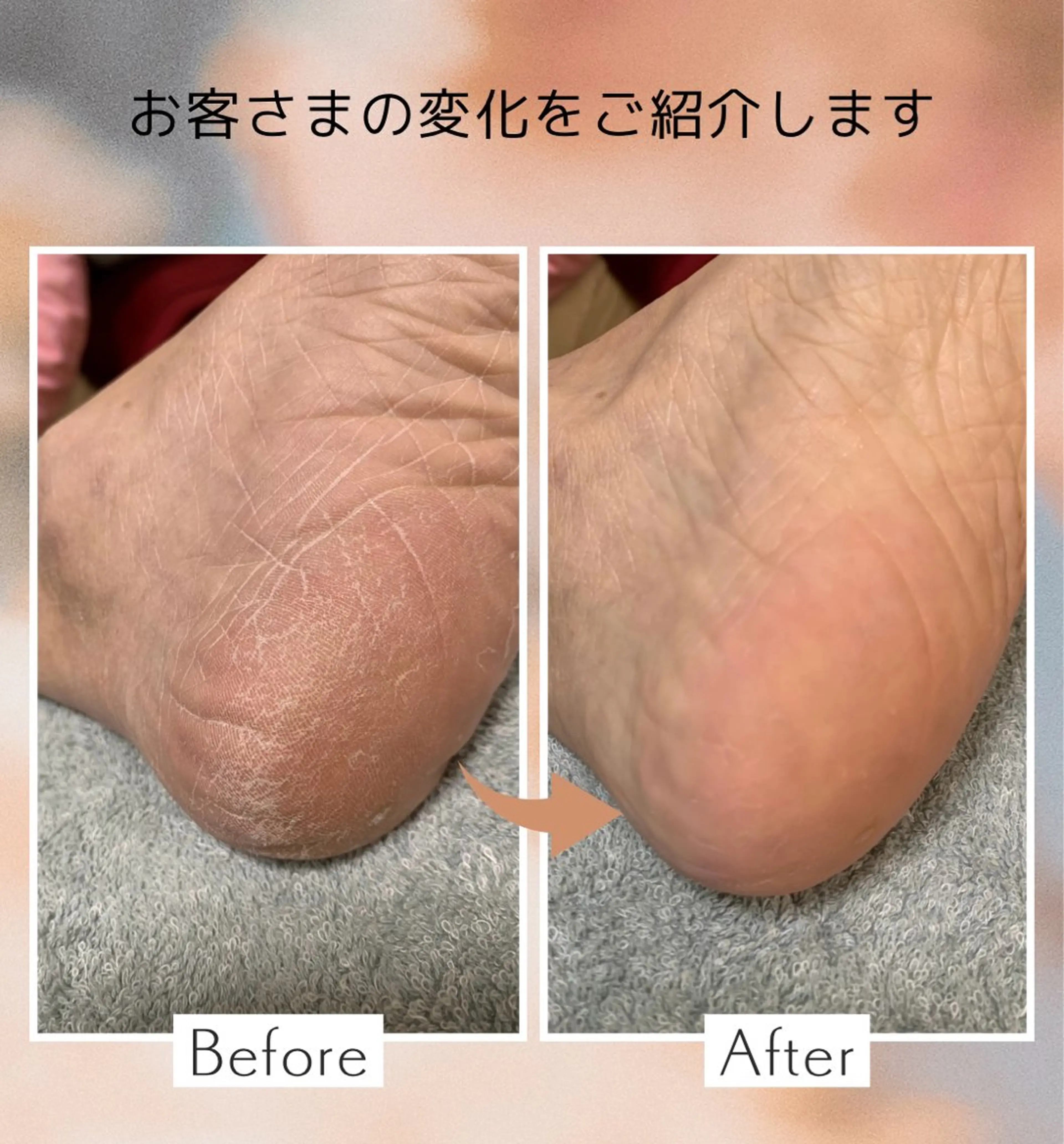 メンズ 【足トラブル専門店】魚の目・巻き爪 フットケアサロン　ニコルル金沢店所属・足トラブル専門 ニコルル金沢のエステ・リラクイメージ