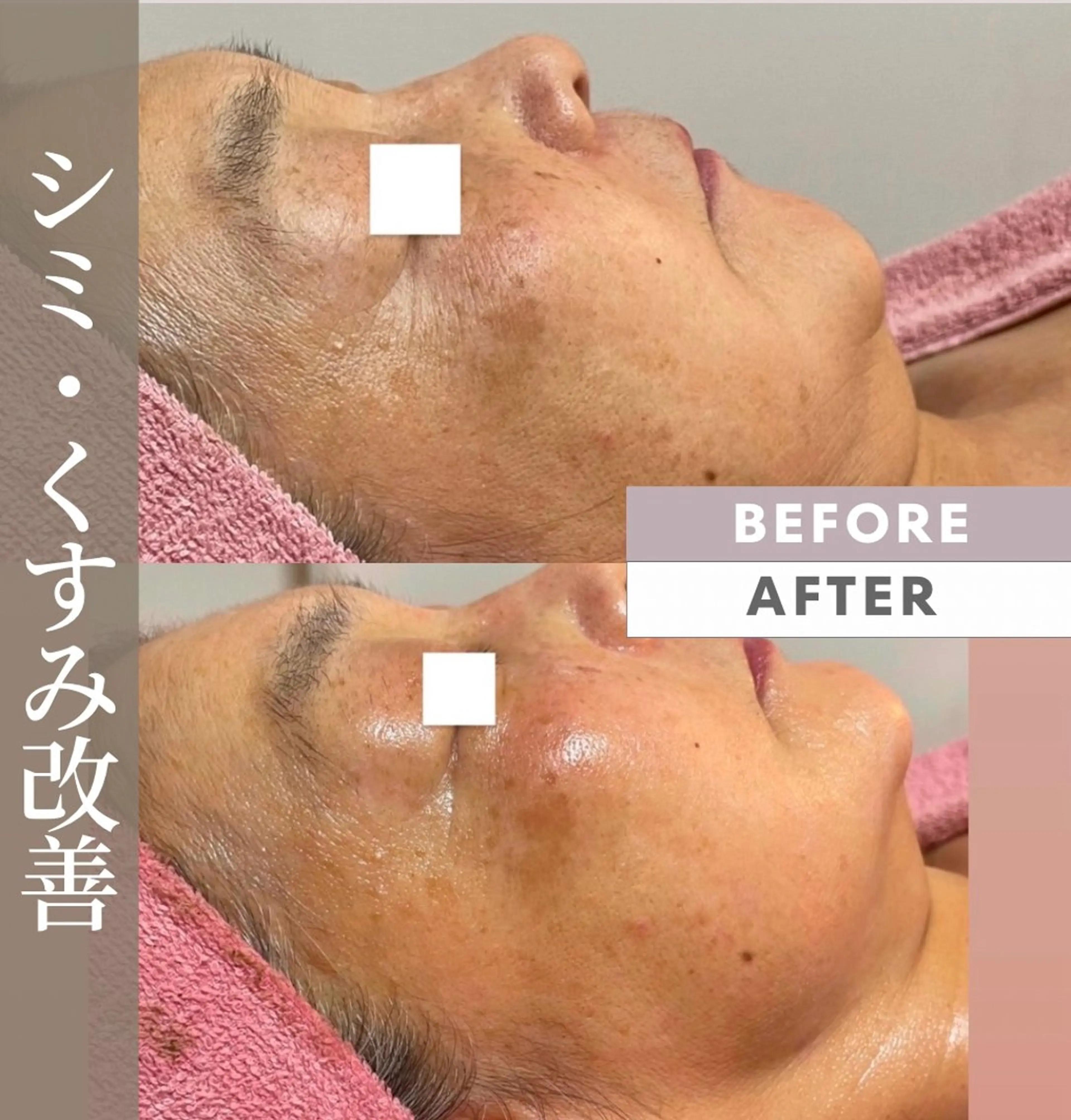 Ulu.肌質・体質改善専門サロン所属・後藤 真美のエステ・リラクイメージ