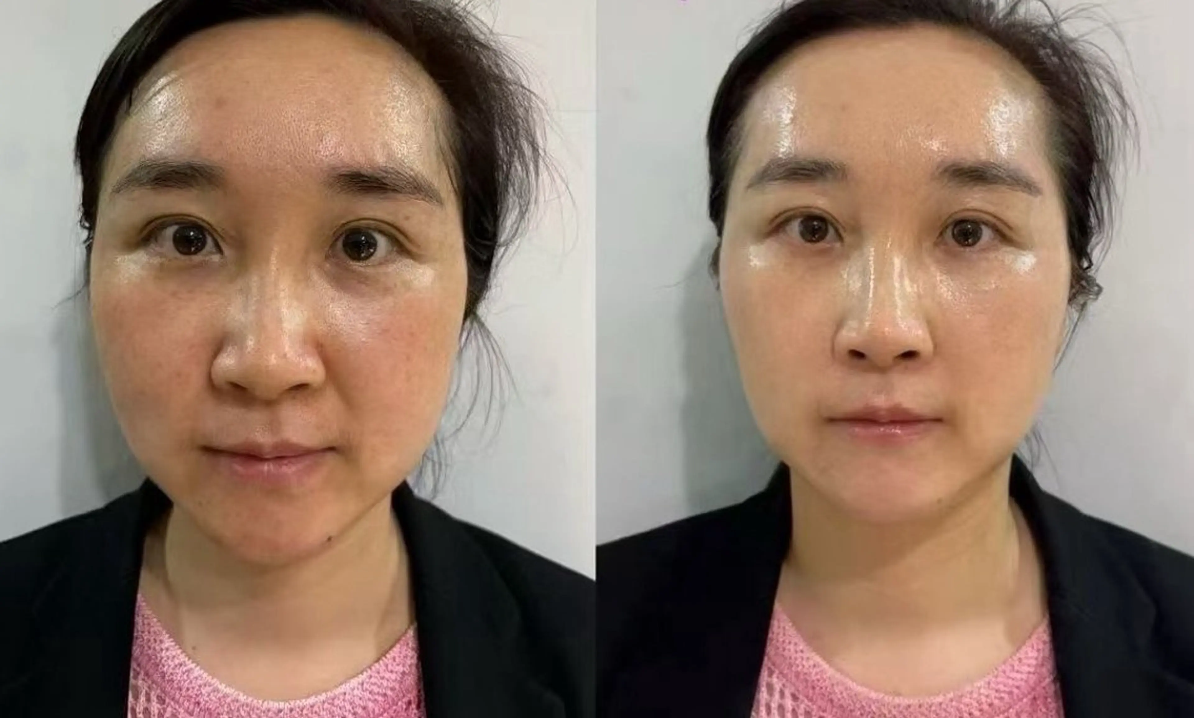 マツエク・マツパ エステ aliaハイフ&水光ジェットサロン所属・aliaハーブ水光店 エステティシャン募集のエステ・リラクイメージ