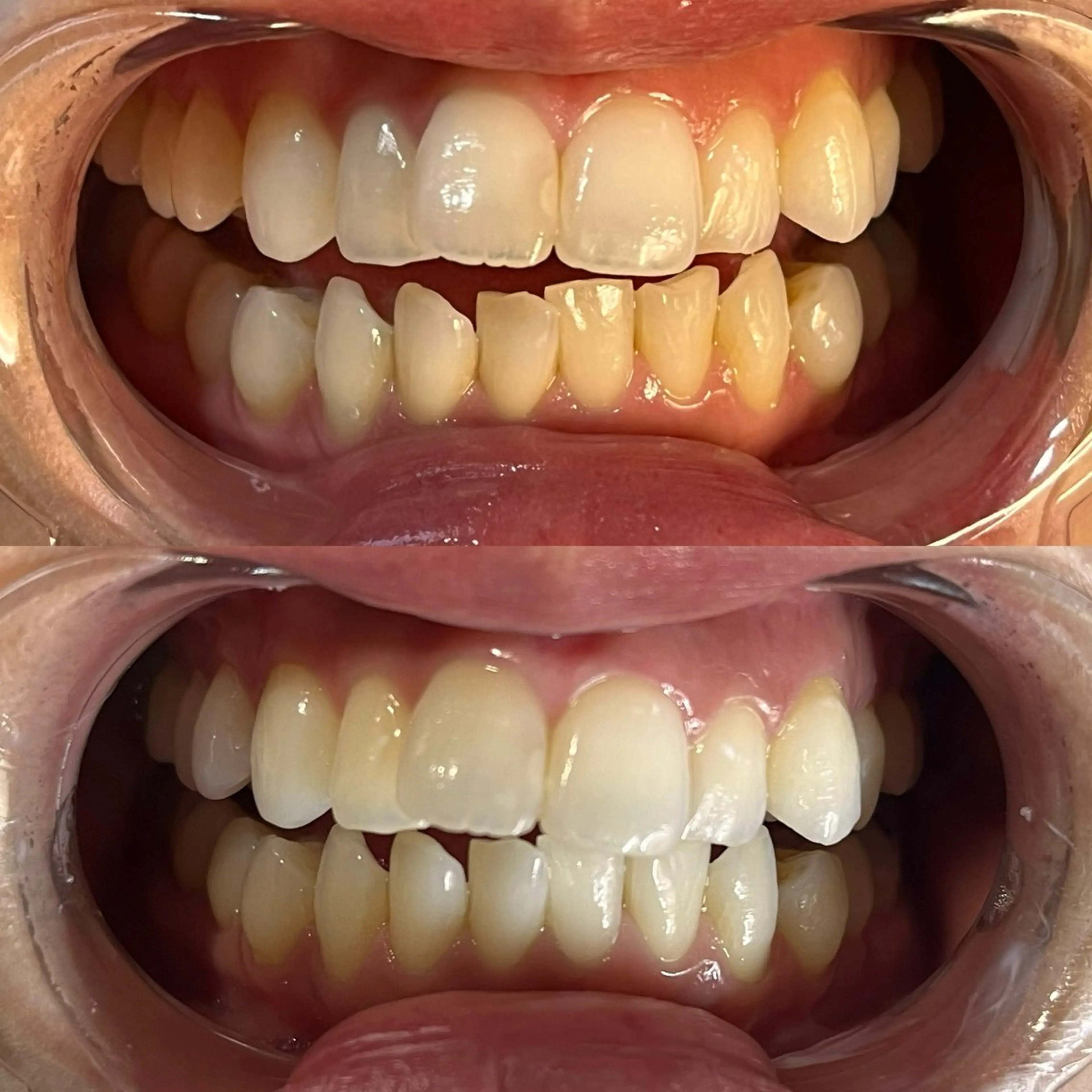 YuA beauty所属・YuA beautyのマツエク・マツパデザイン