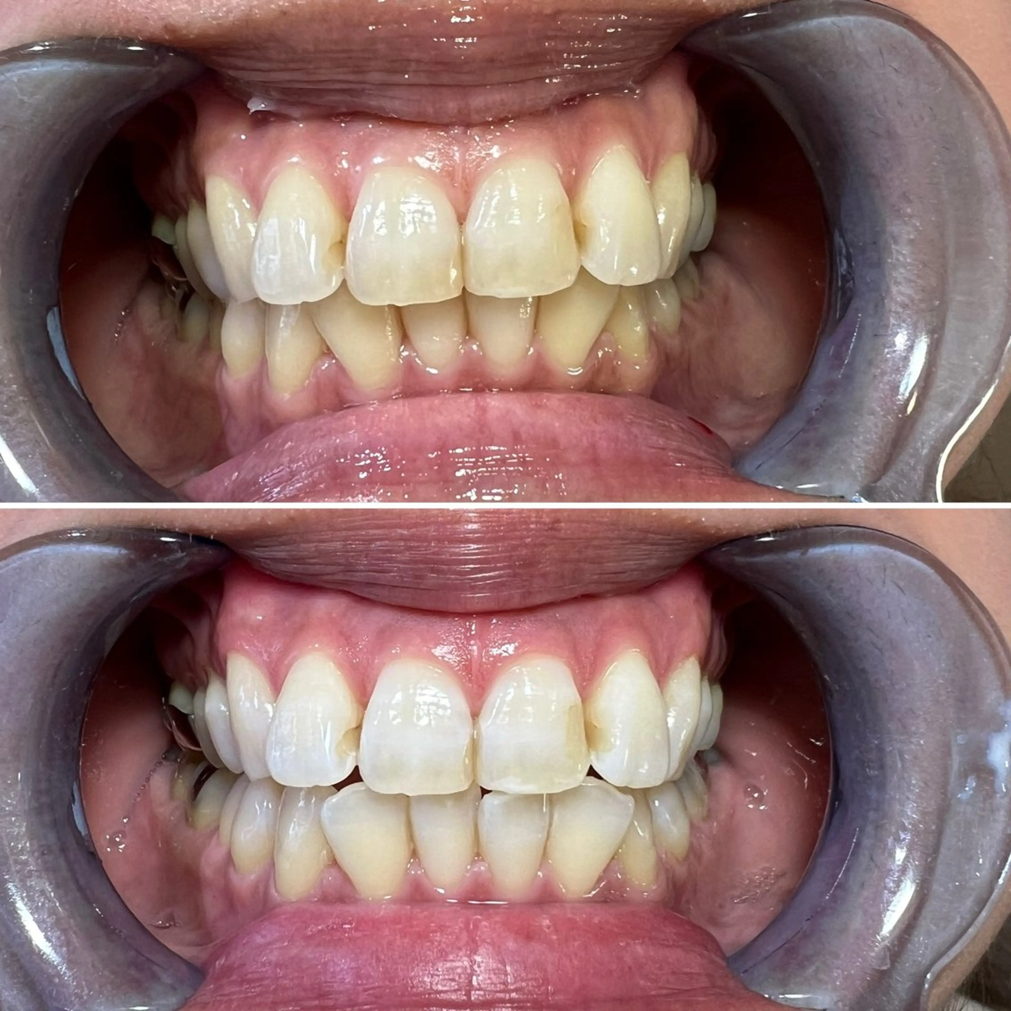 セルフホワイトニング Shineeのエステ・リラクイメージ