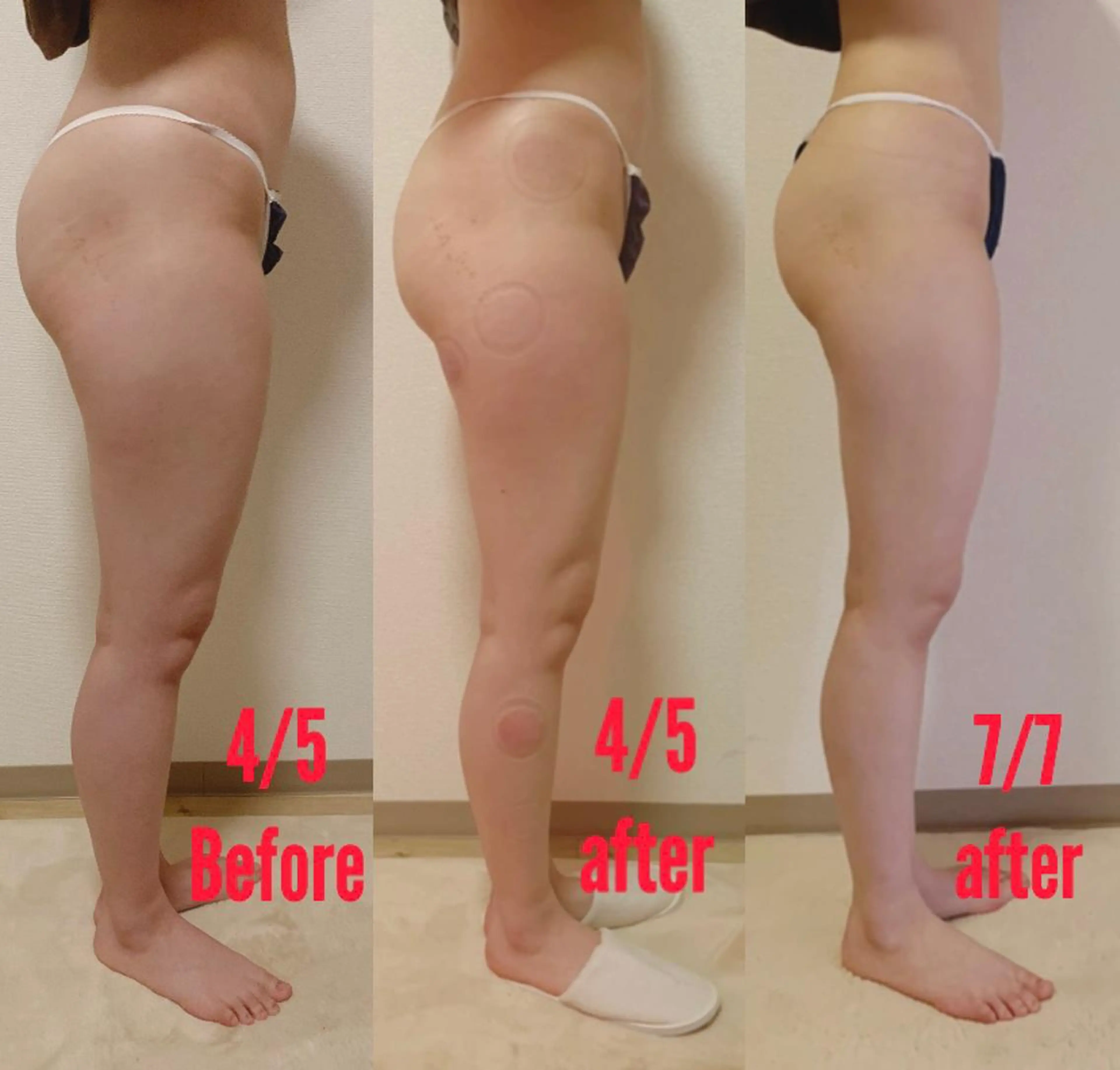 a  room salonのエステ・リラクイメージ