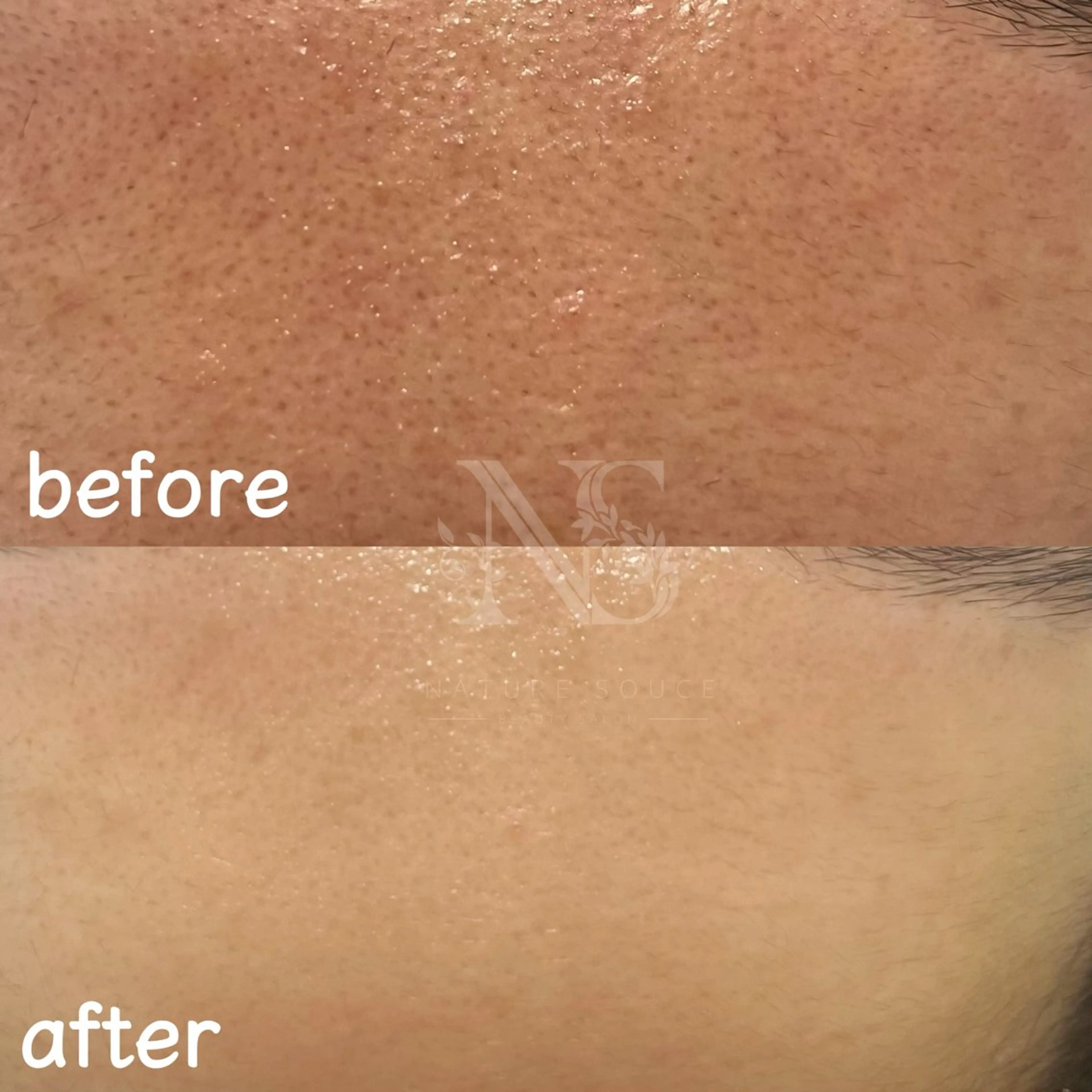 Nature Souce毛穴専門店のその他イメージ