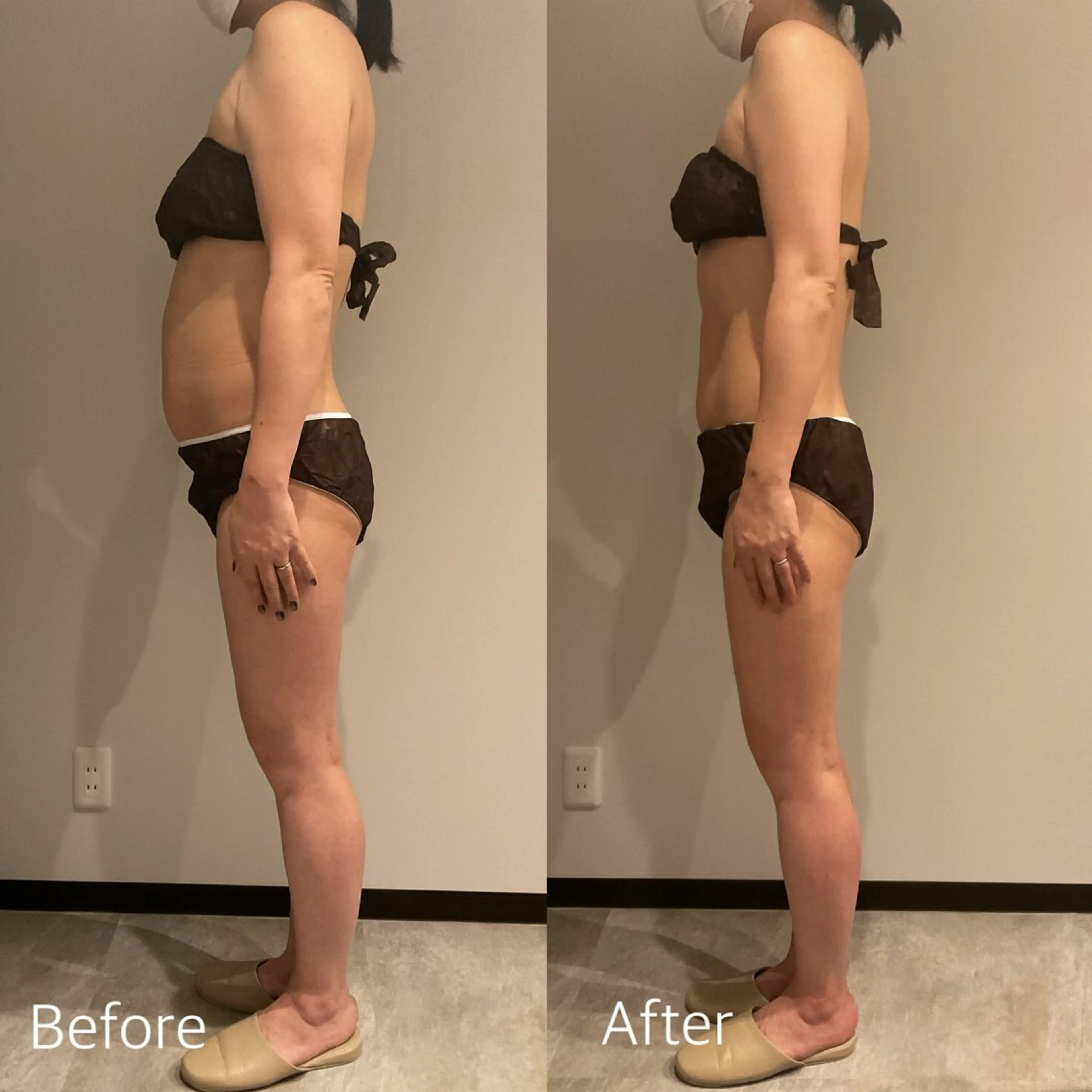 エステ リラク Esthetic MiEUXのエステ・リラクイメージ