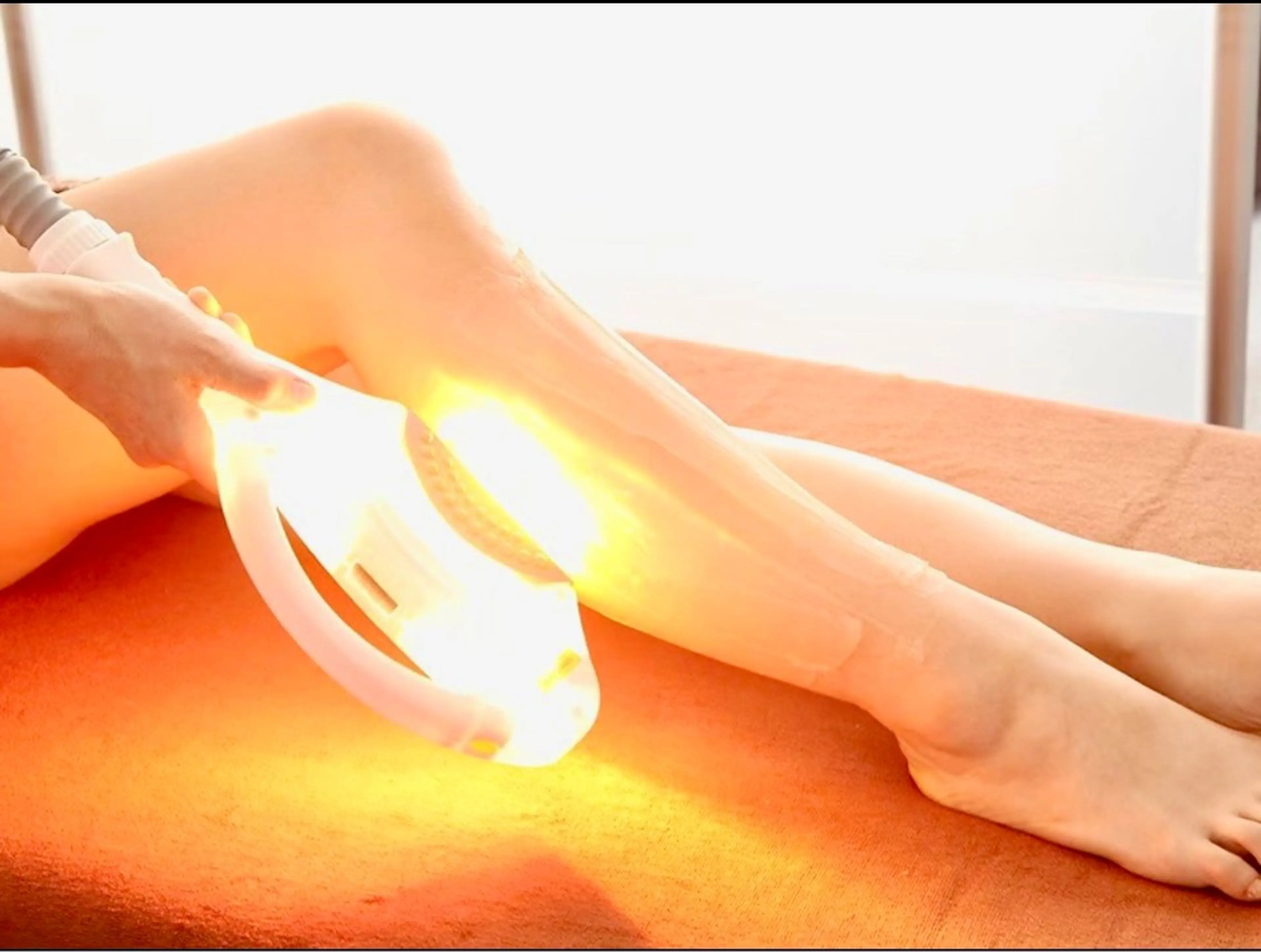 【ルミクス脱毛】　Ｌパーツ　（VIO・背中・両うで全体・両あし全体など）の写真