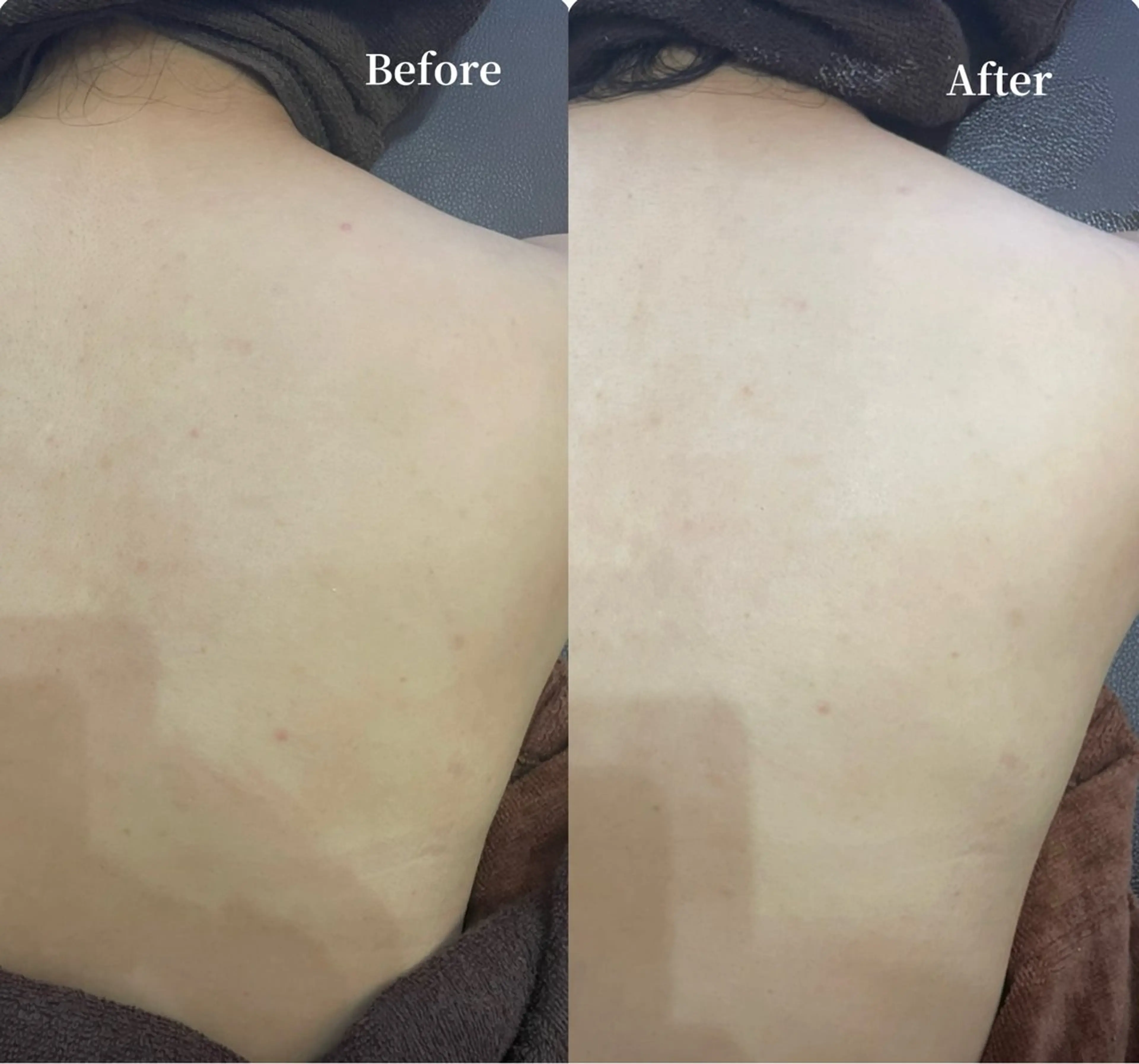 エステ リラク Private SalonOboraのエステ・リラクイメージ