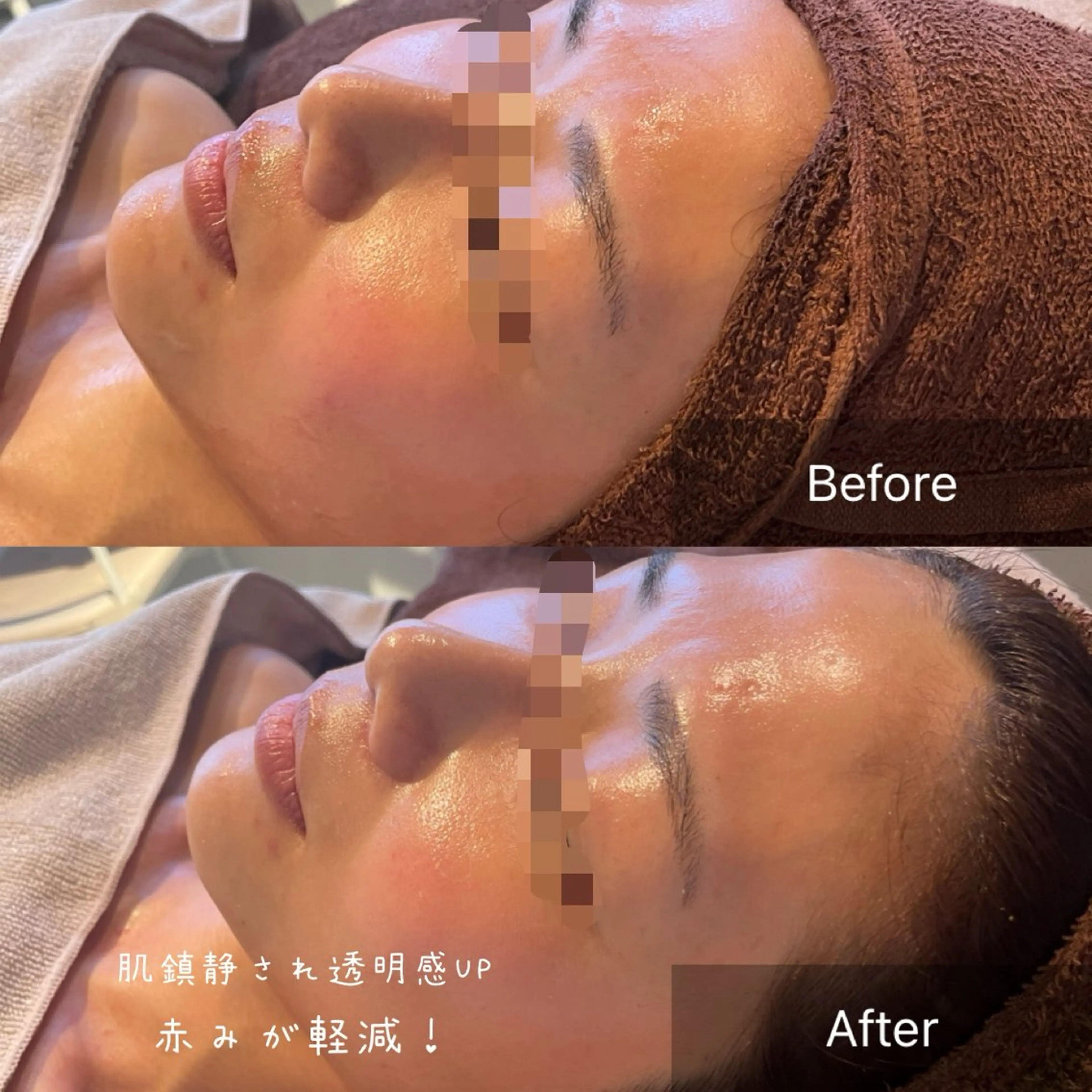 NA skin たまプラーザ　川島のエステ・リラクイメージ