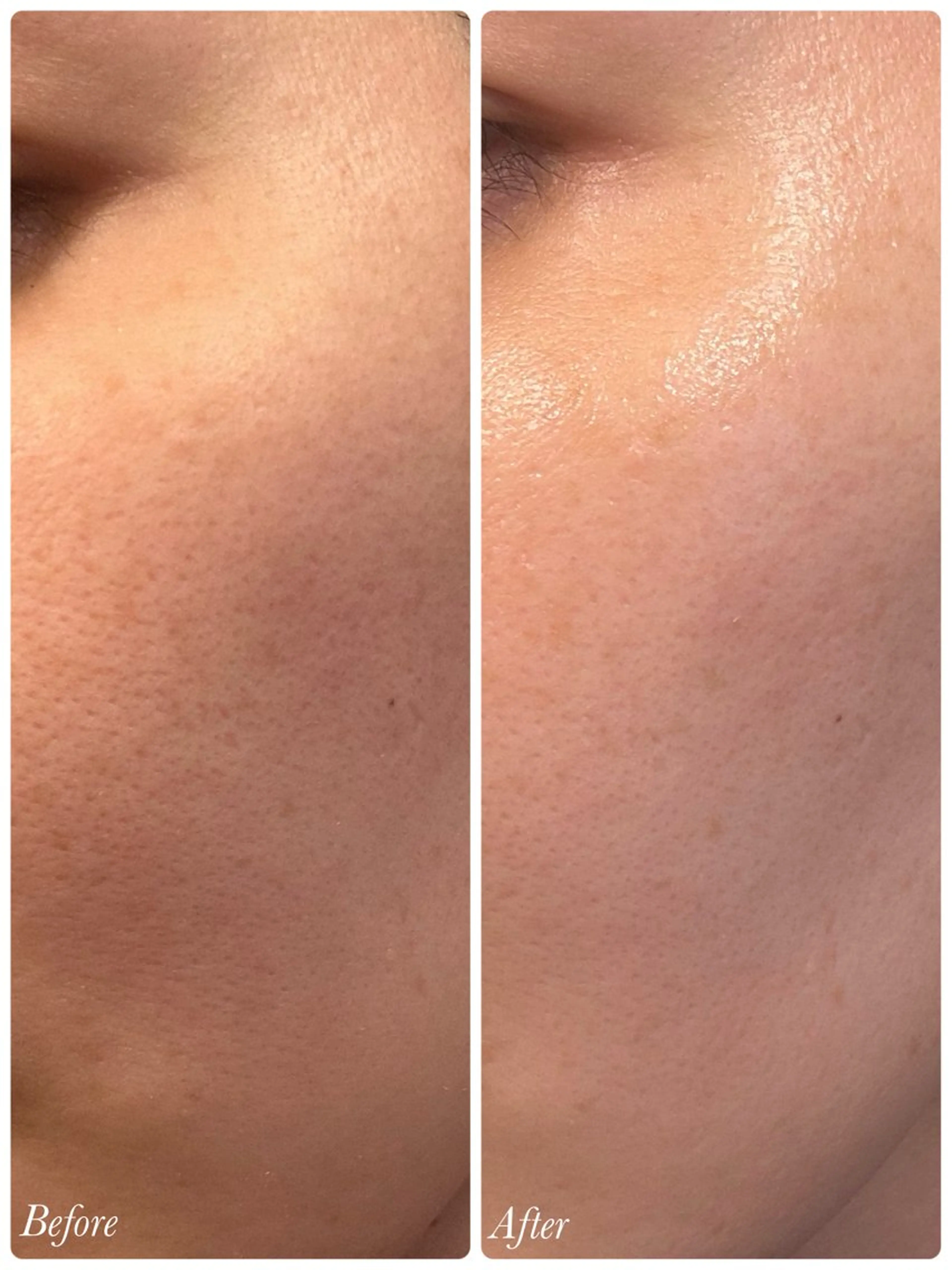 その他 SPA&BEAUTY Shanaのエステ・リラクイメージ