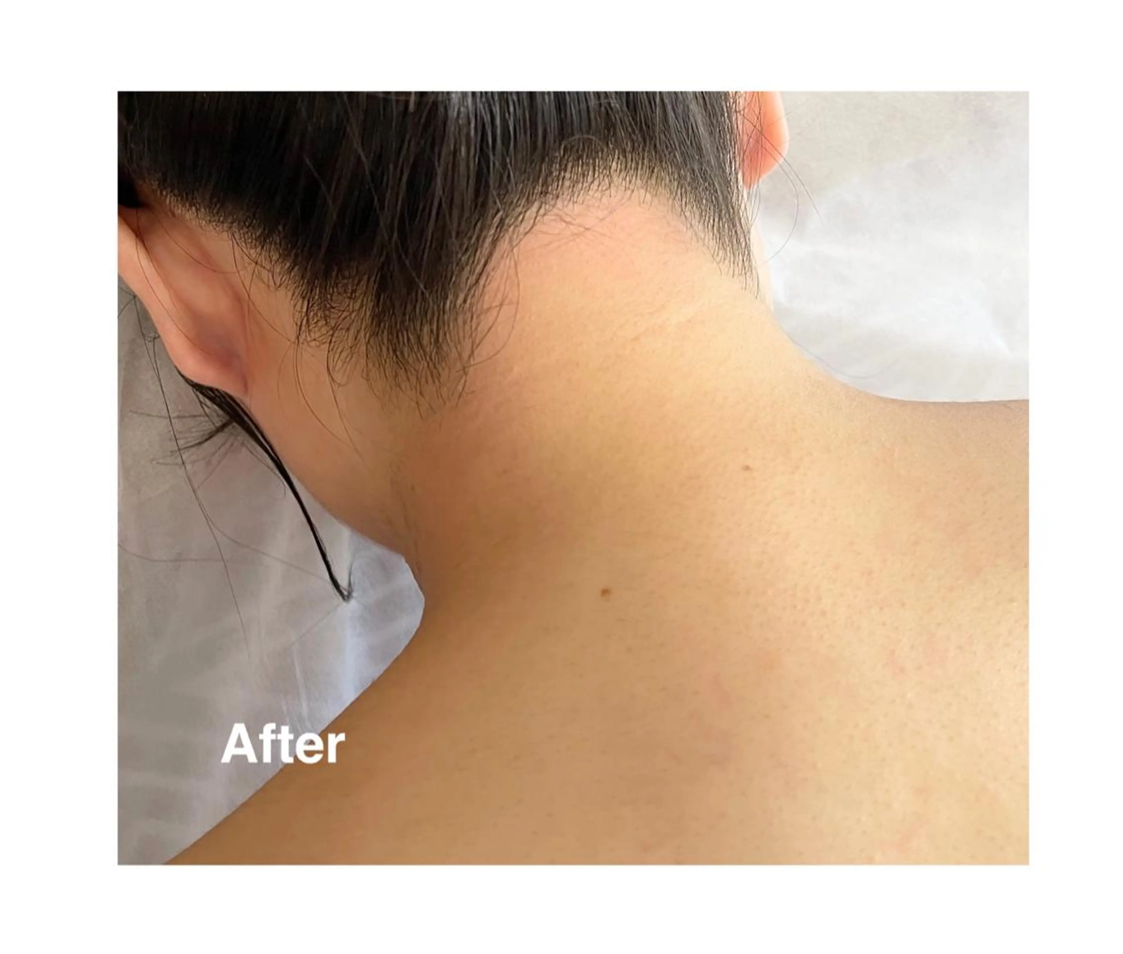 地上のトレチカ sugaringのエステ・リラクイメージ