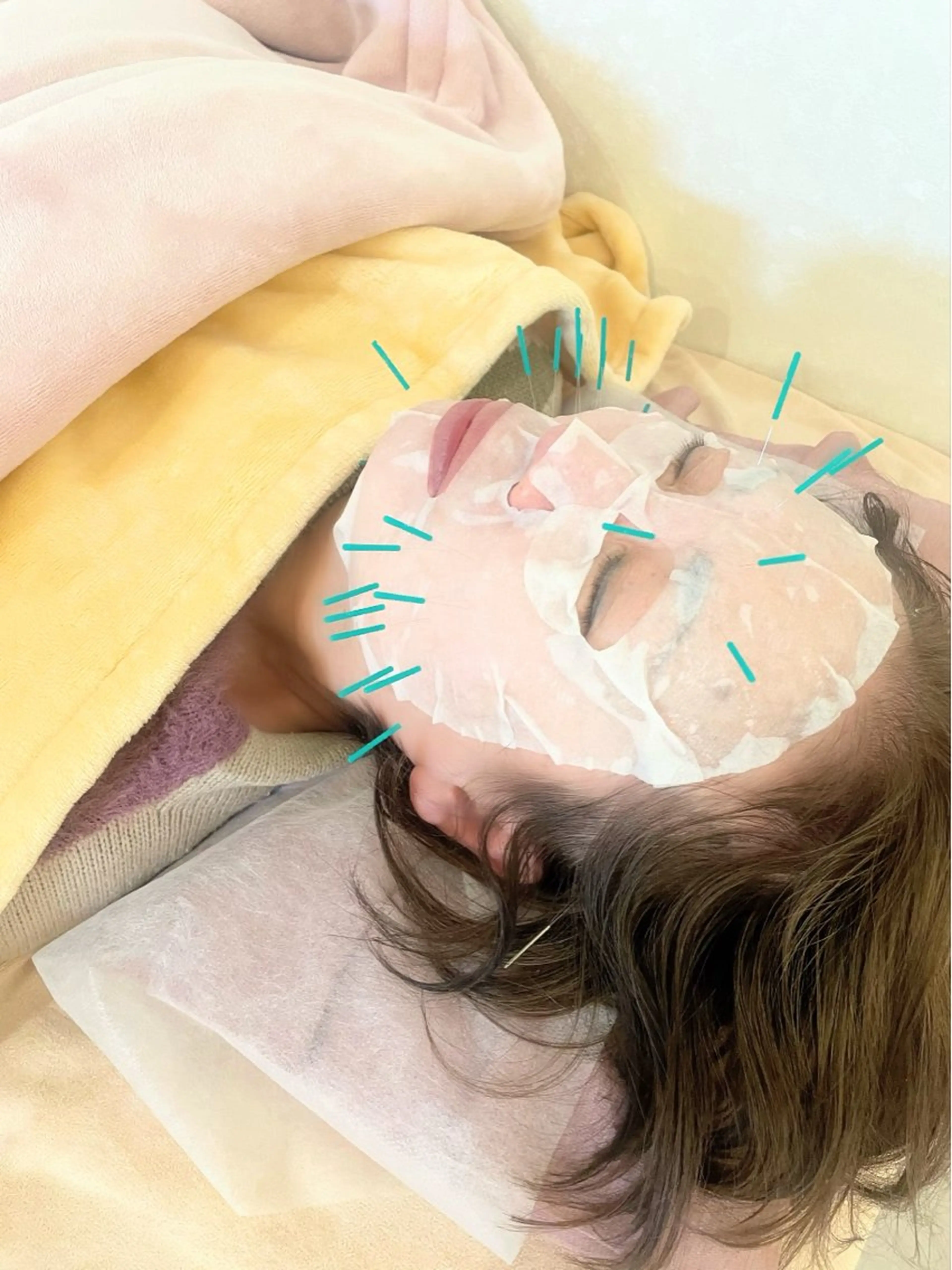【妊活・美容鍼専門】Aran鍼灸院所属・【美容鍼・不妊専門】 Aran鍼灸院のエステ・リラクイメージ