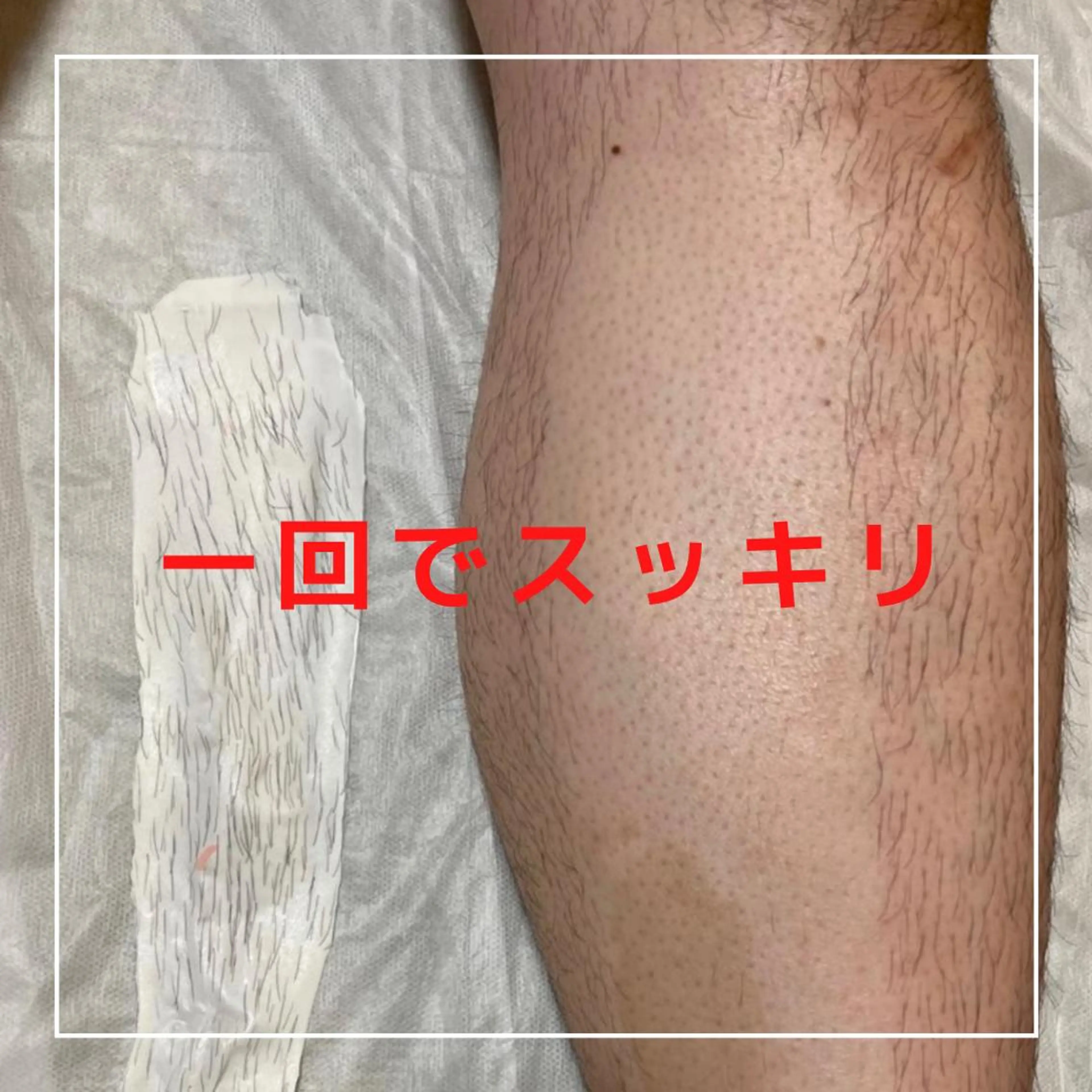 《人気No.3🏆》脚ワックス脱毛🕊両脚上or両脚下(どちらか選択)🌻ちくちくバイバイ✨美脚ケア🙆♀️メンズOKの写真