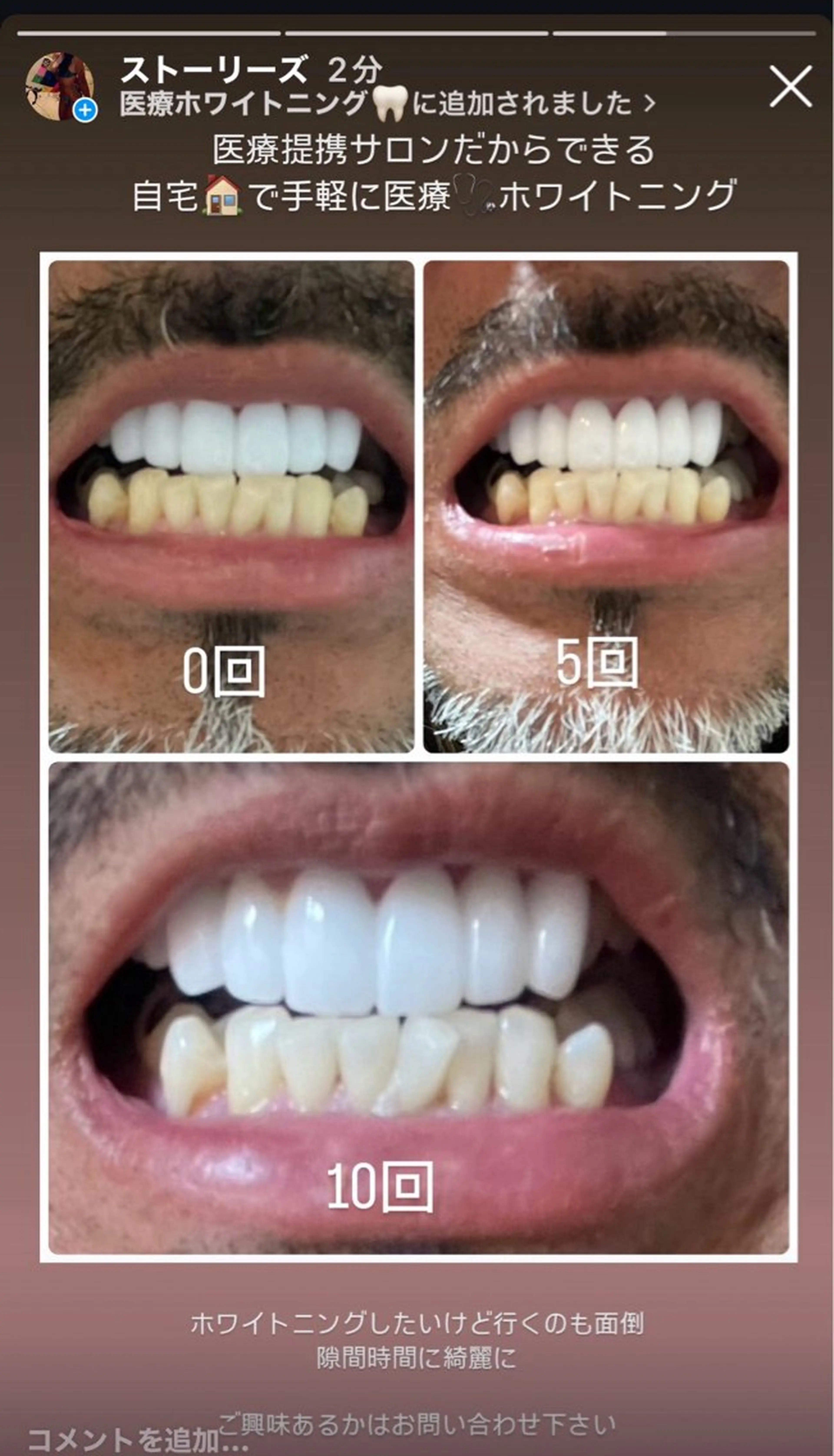 private salon  Dea_maris シュガーリング＆パーソナルボディケア所属・シミ改善・韓国肌管理 ボディメイク痩身のその他イメージ