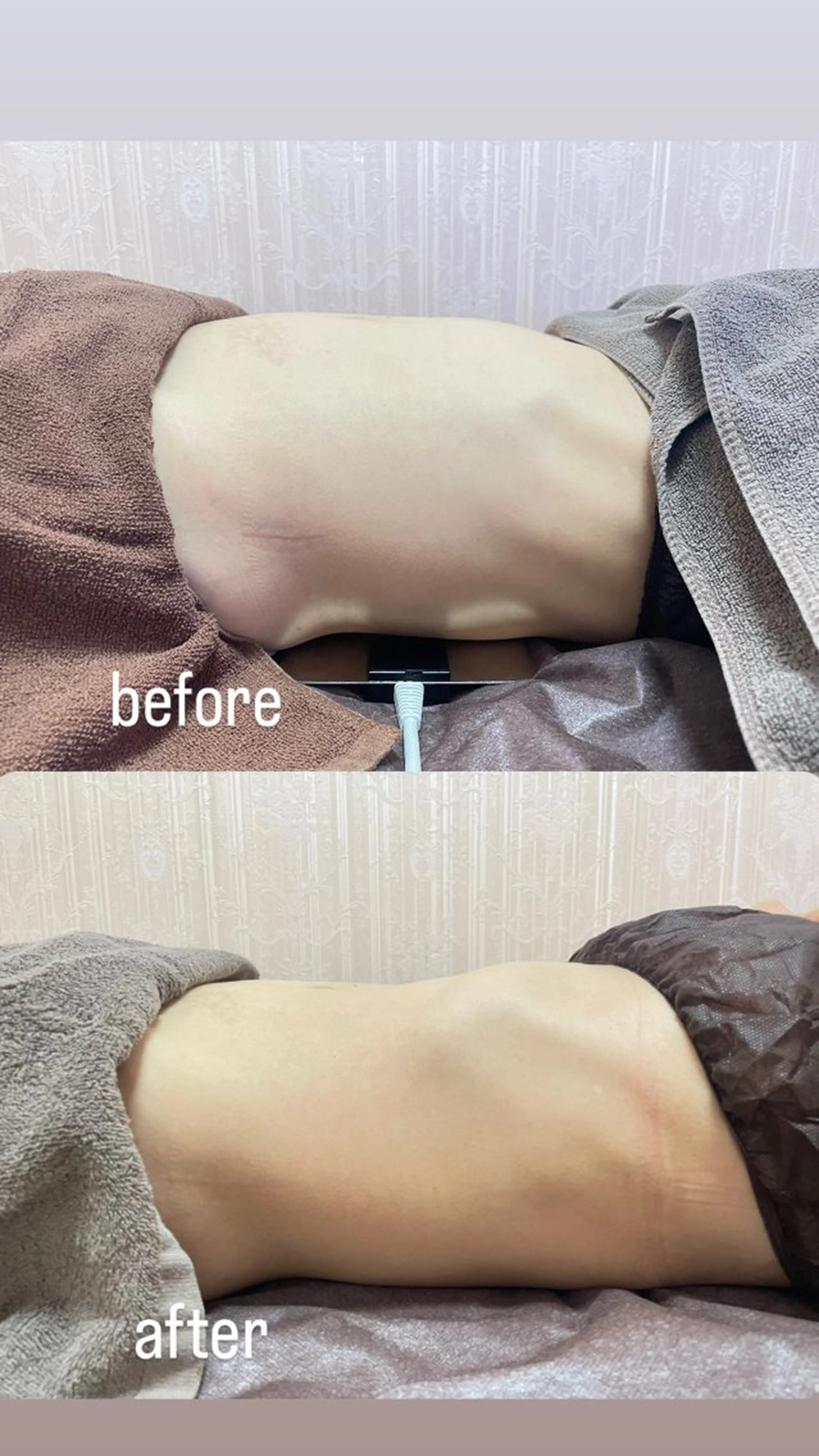 無駄肉さよなら👋🏼✨お試しお腹フォースカッターの写真