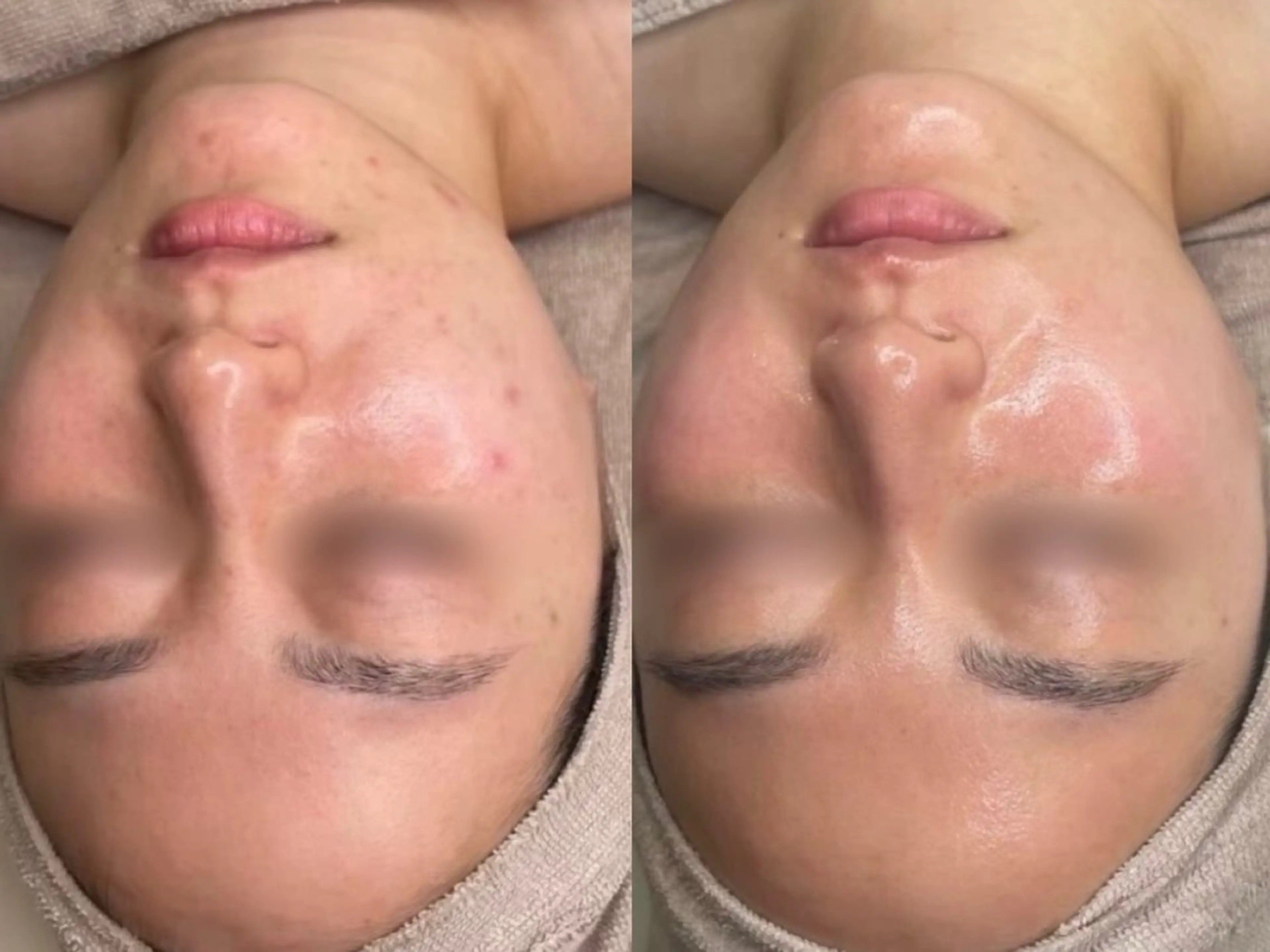 肌質改善・毛穴サロン Chéfiaのエステ・リラクイメージ