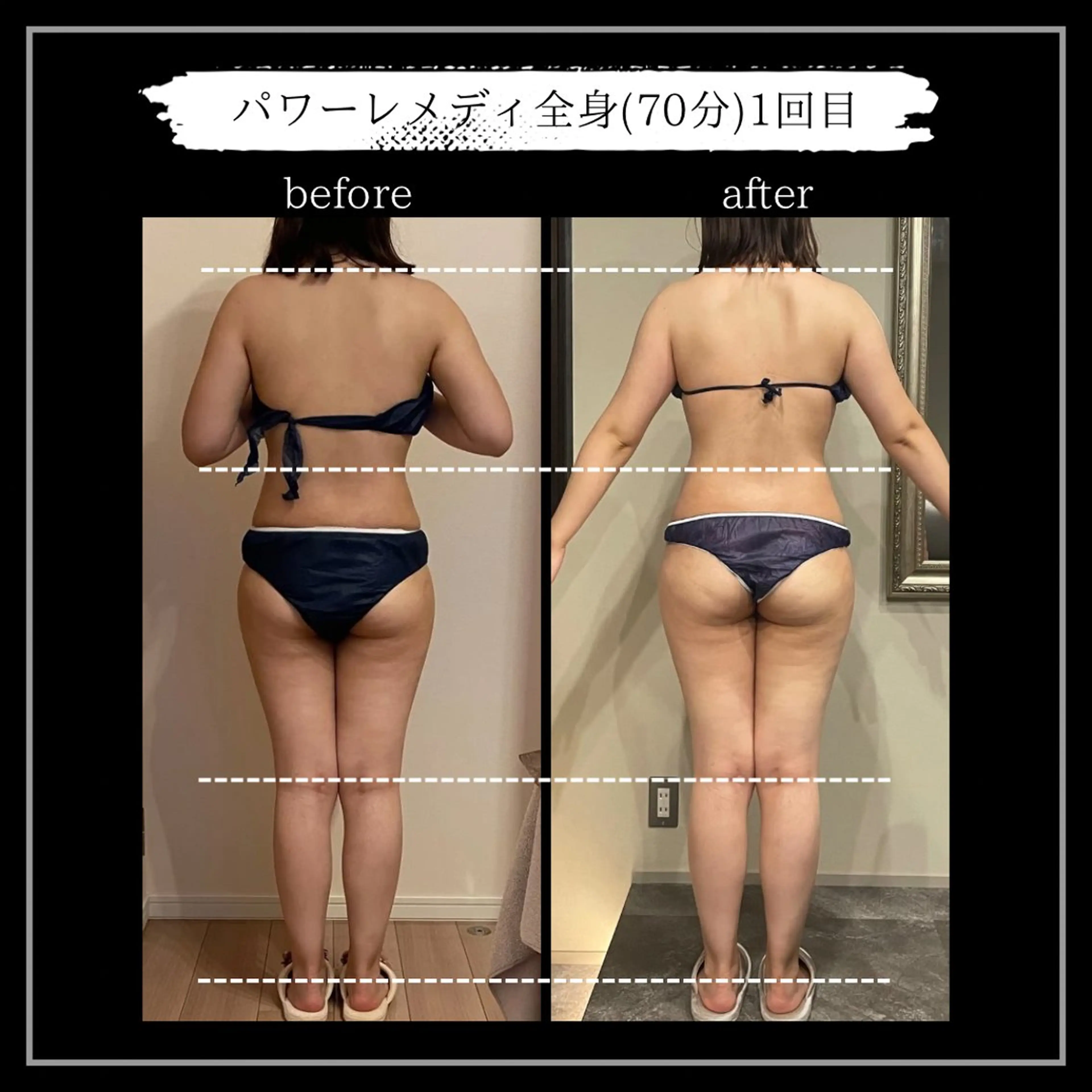 オフ:オン所属・オフ:オン 全身筋膜マッサージのエステ・リラクイメージ