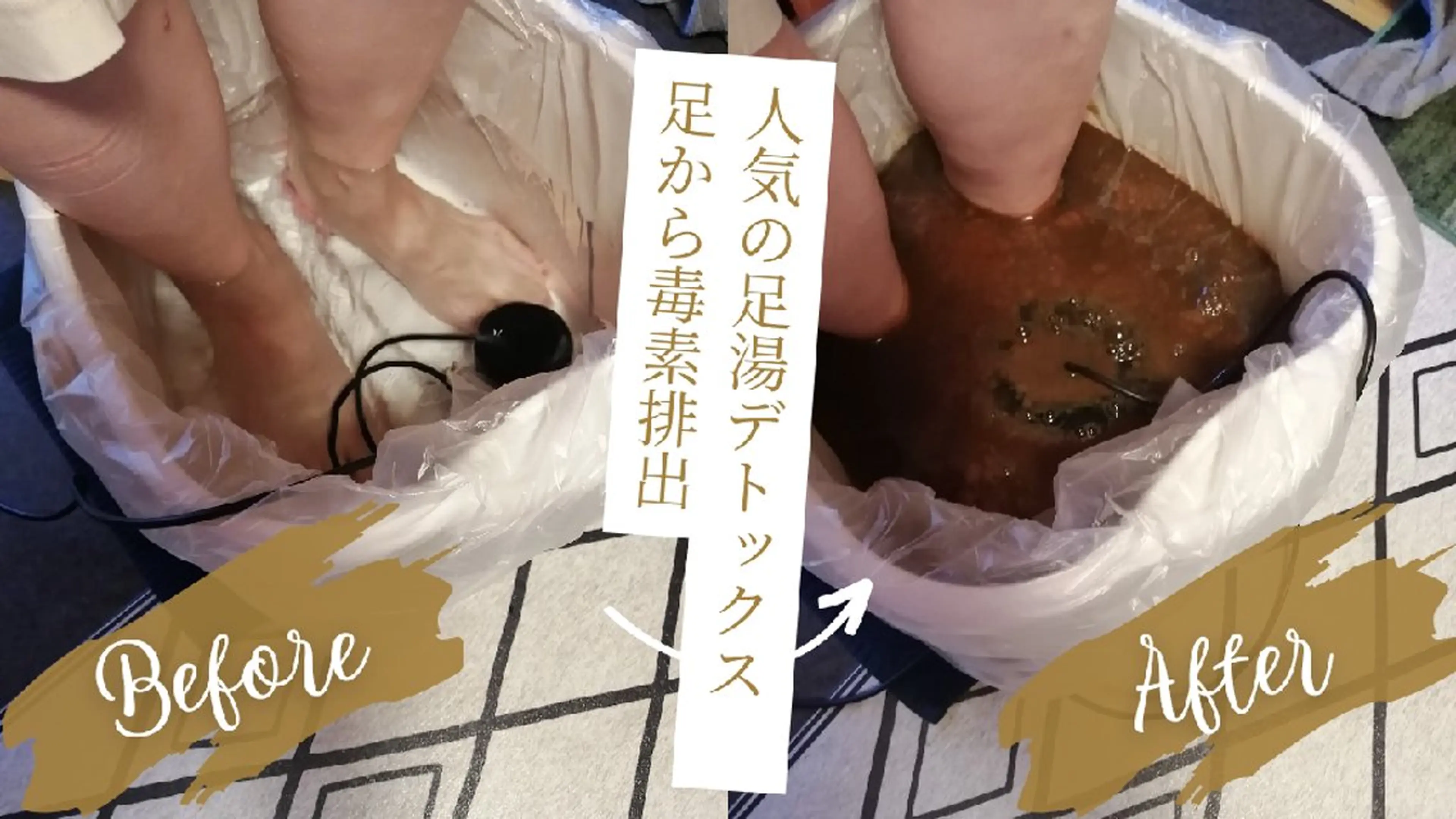 足湯デトックス（足の裏から老廃物をデトックス）の写真