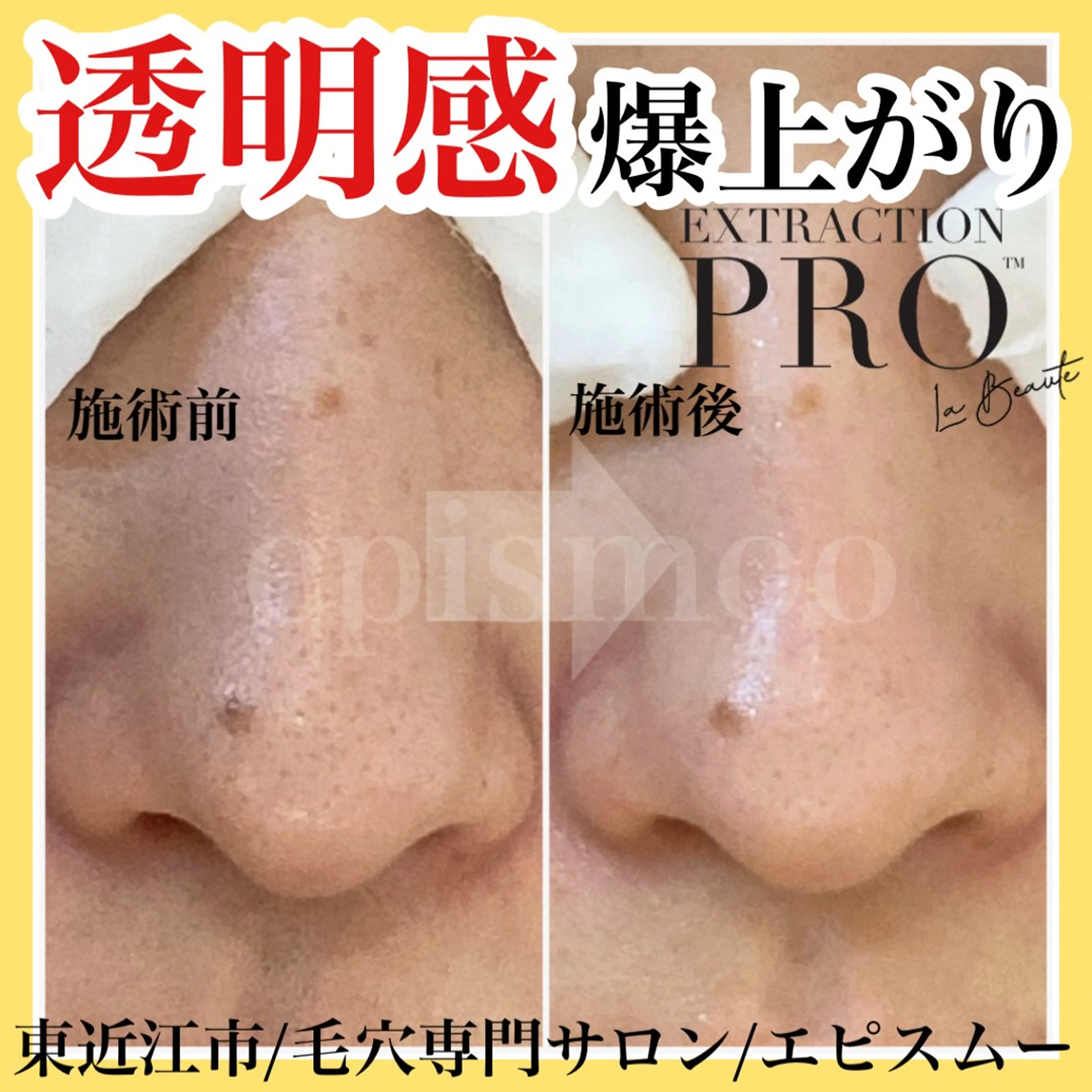 epismoo 脱毛/HBL/毛穴の眉毛・アイブロウイメージ