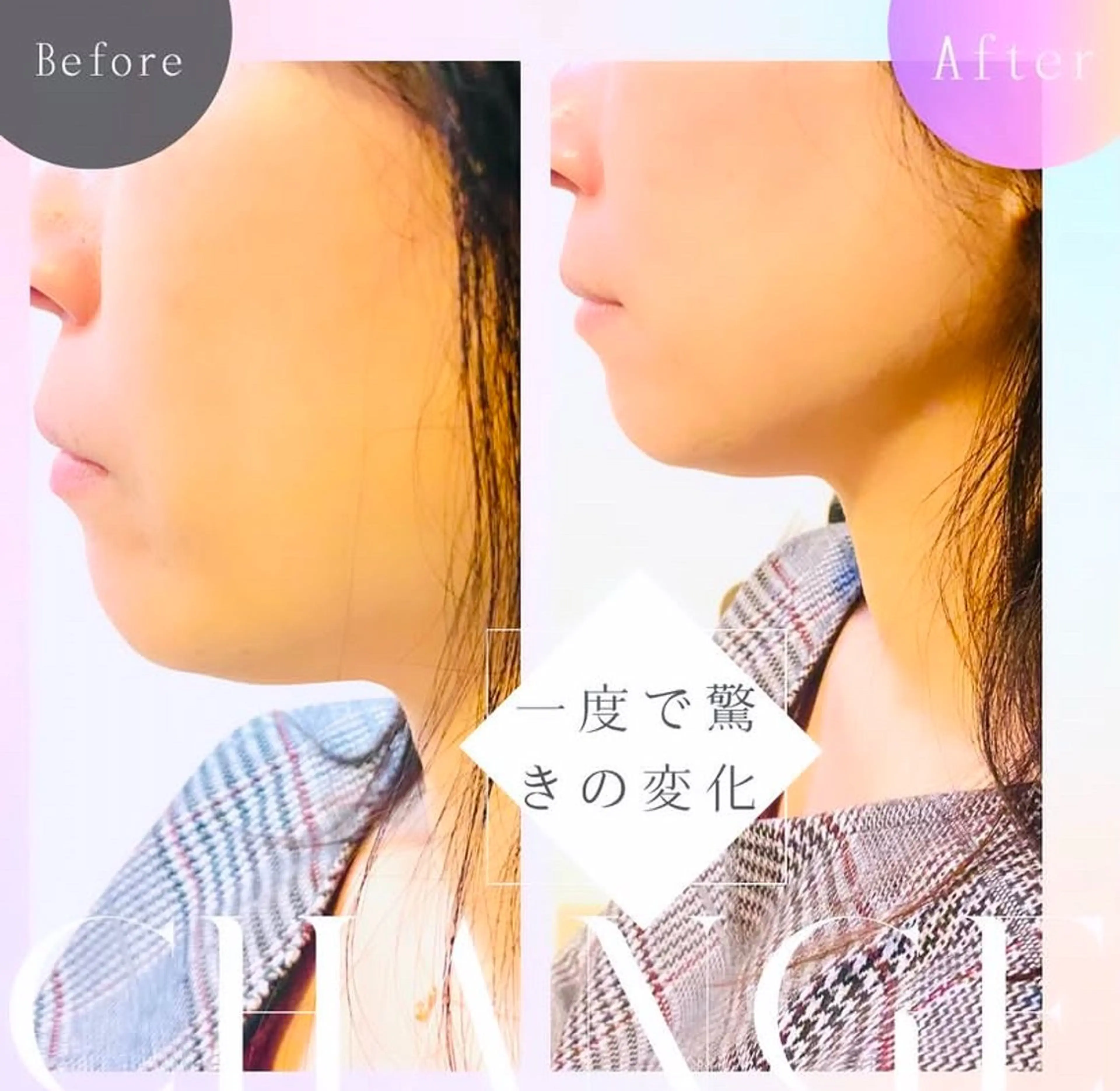 小顔フェイシャル30%オフの写真