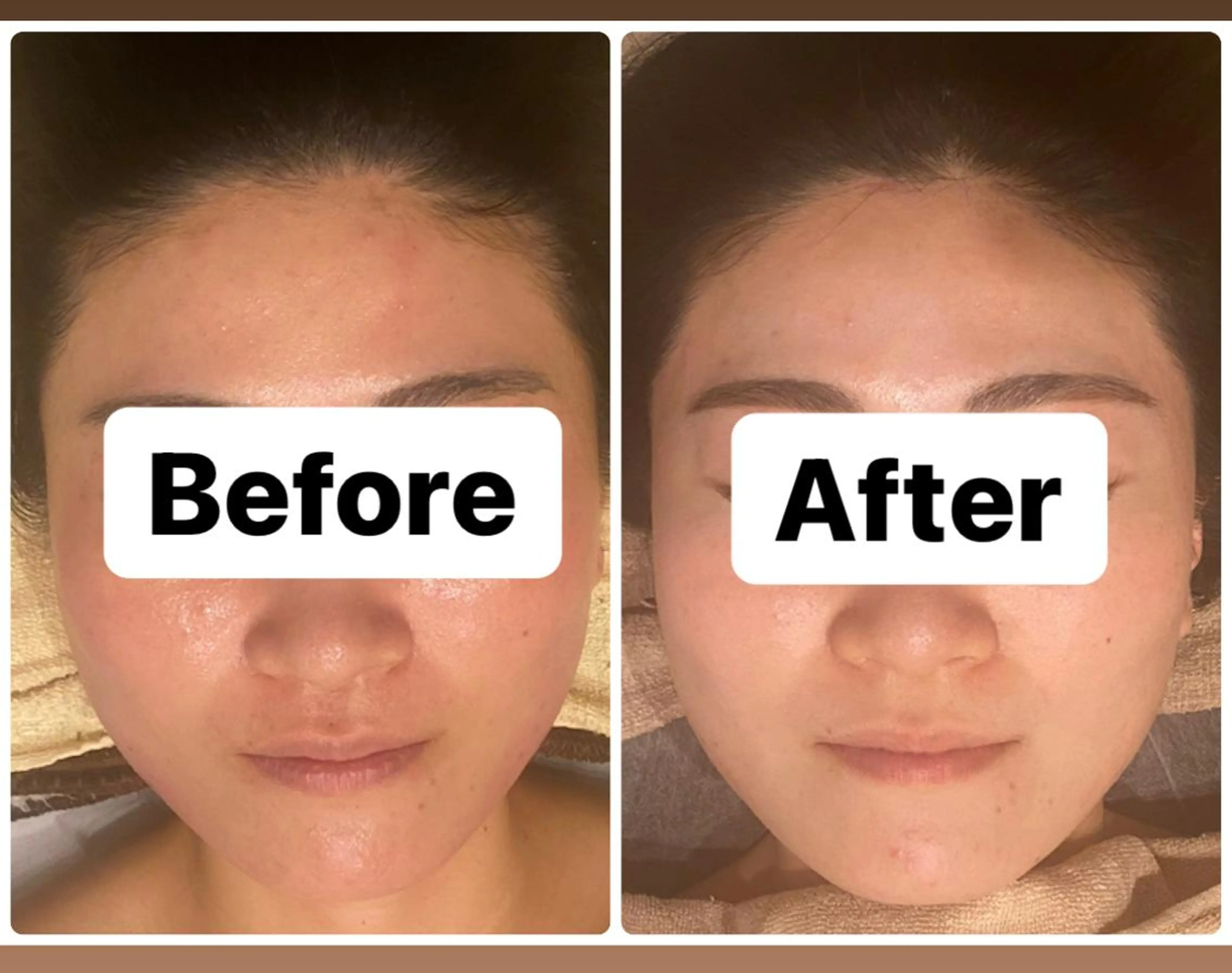 ハーブピーリング専門 muro.のエステ・リラクイメージ