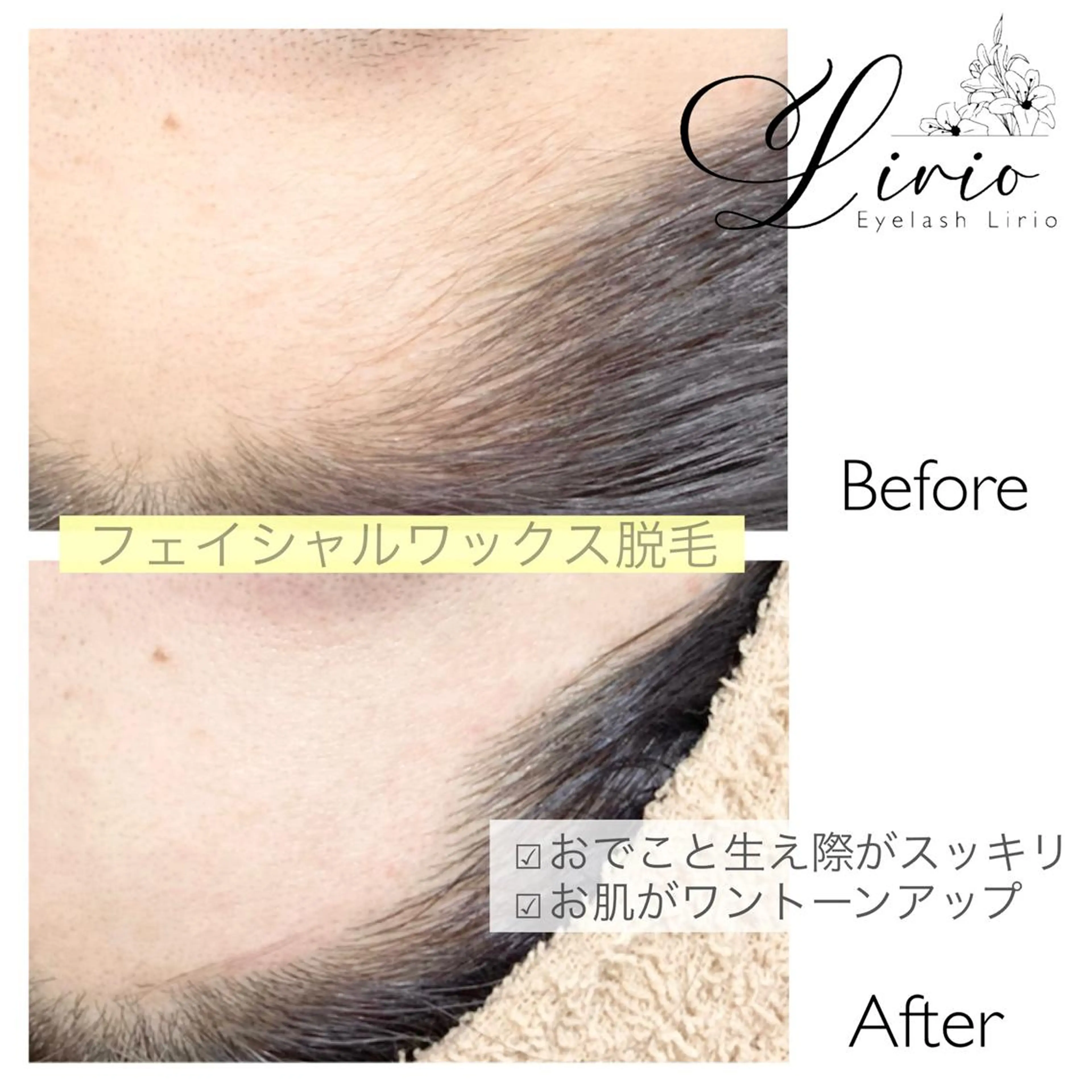 脱毛 Eyelash Lirio所属・EyeLash Lirio リリオのエステ・リラクイメージ