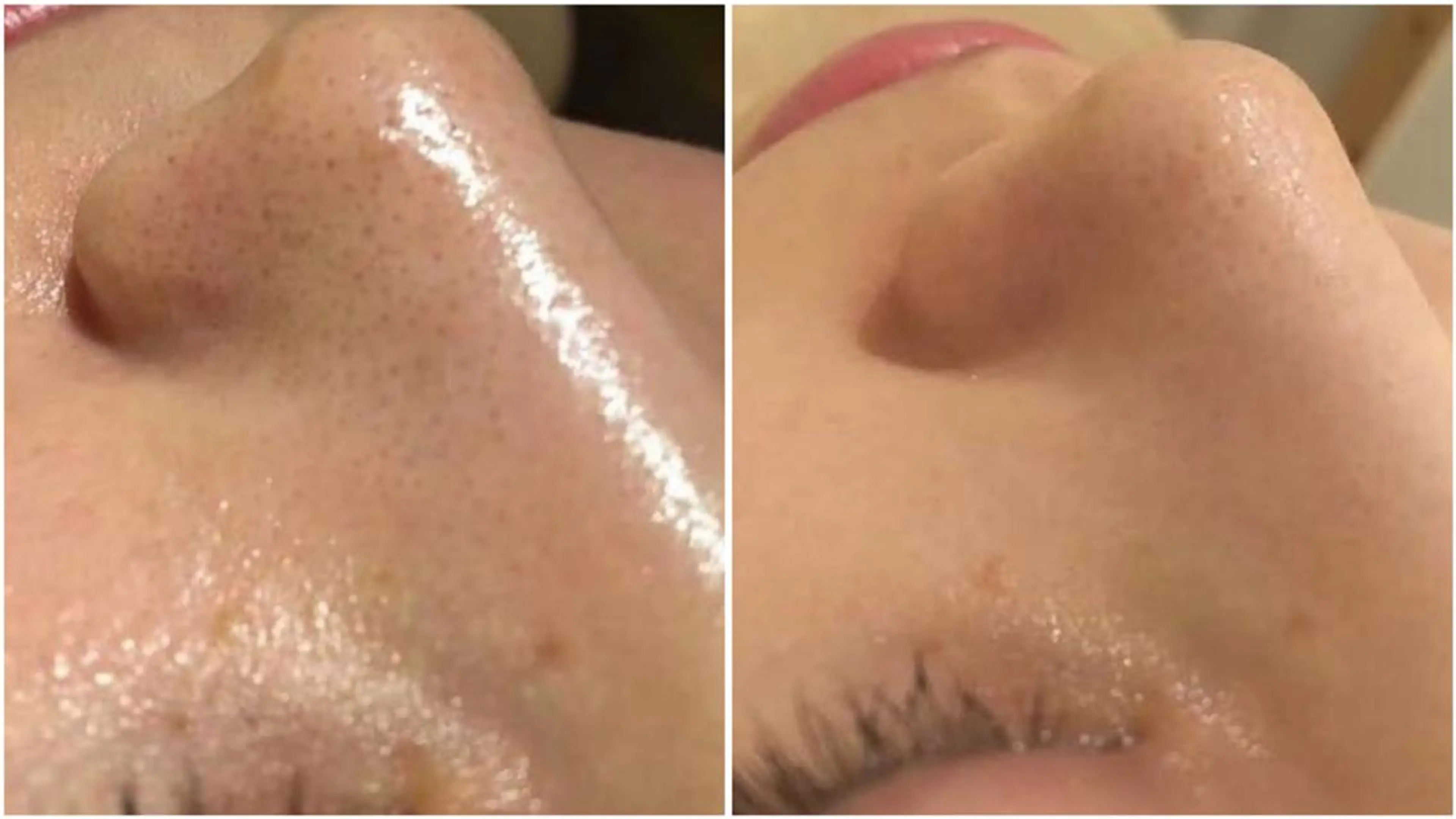 エステ リラク 夏までに肌荒れ卒業 するサロン🌻のエステ・リラクイメージ