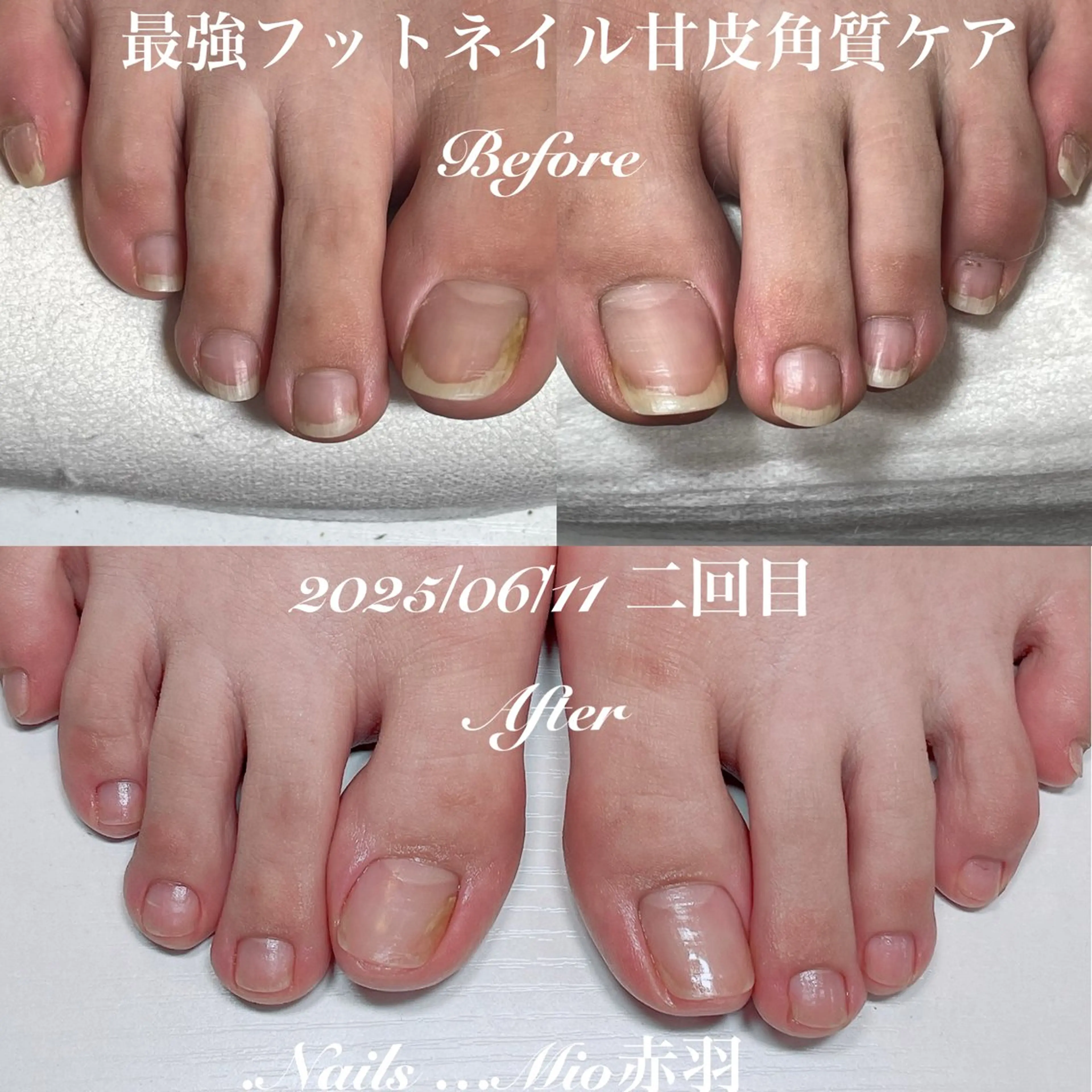 ネイル フットネイル ジェルネイル .Nails Mio 赤羽西ネイルサロンのネイルデザイン