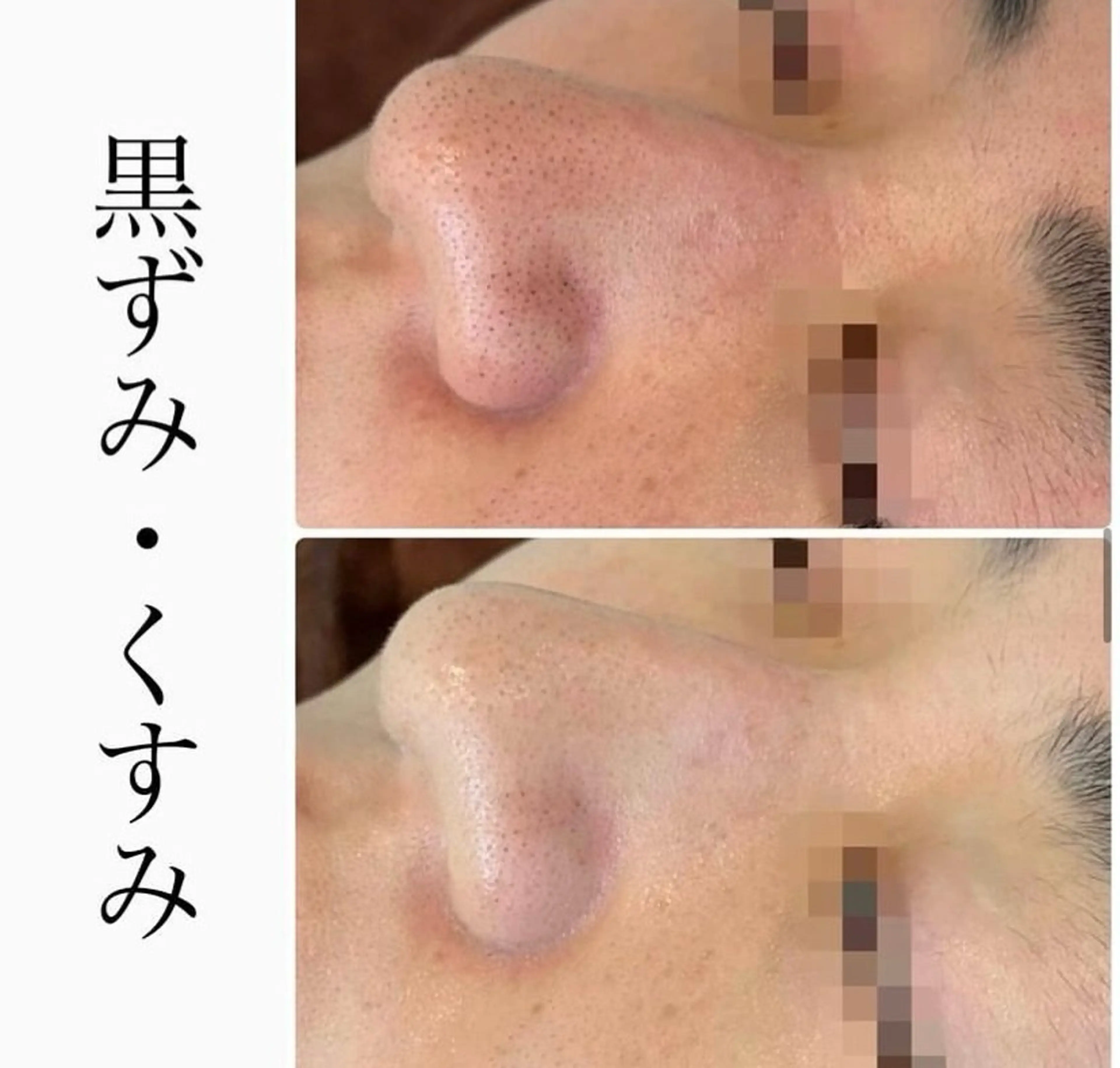 エステ ハーブピーリング専門 BIOPLUS＋川崎のエステ・リラクイメージ