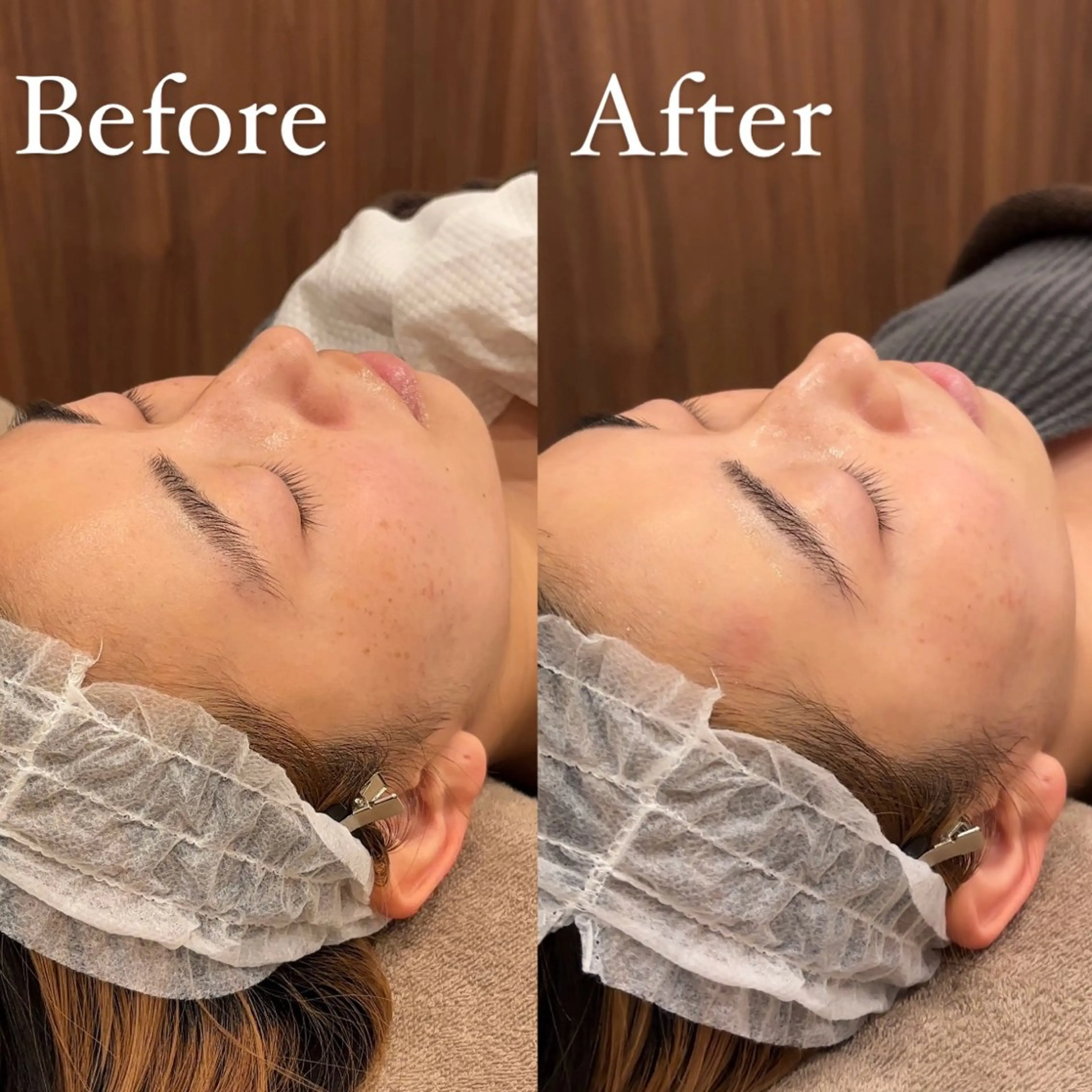 Hari Lounge恵比寿所属・chika🦋 ハリラウンジ恵比寿のエステ・リラクイメージ