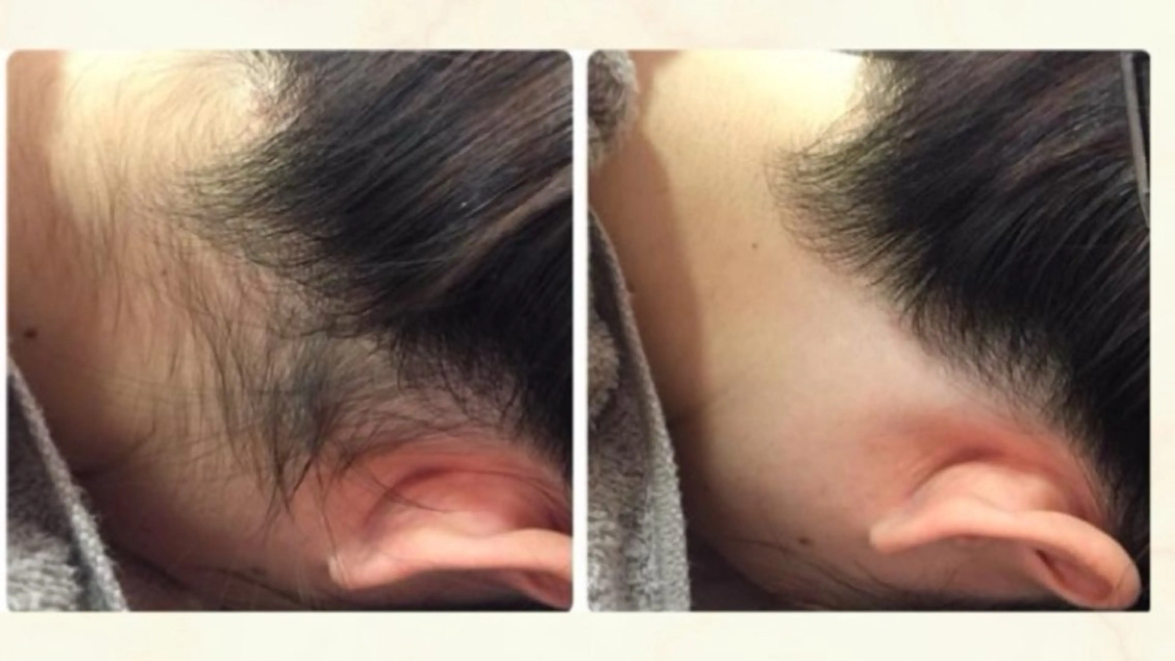 脱毛専門減毛サロン LULU.tokyoのエステ・リラクイメージ