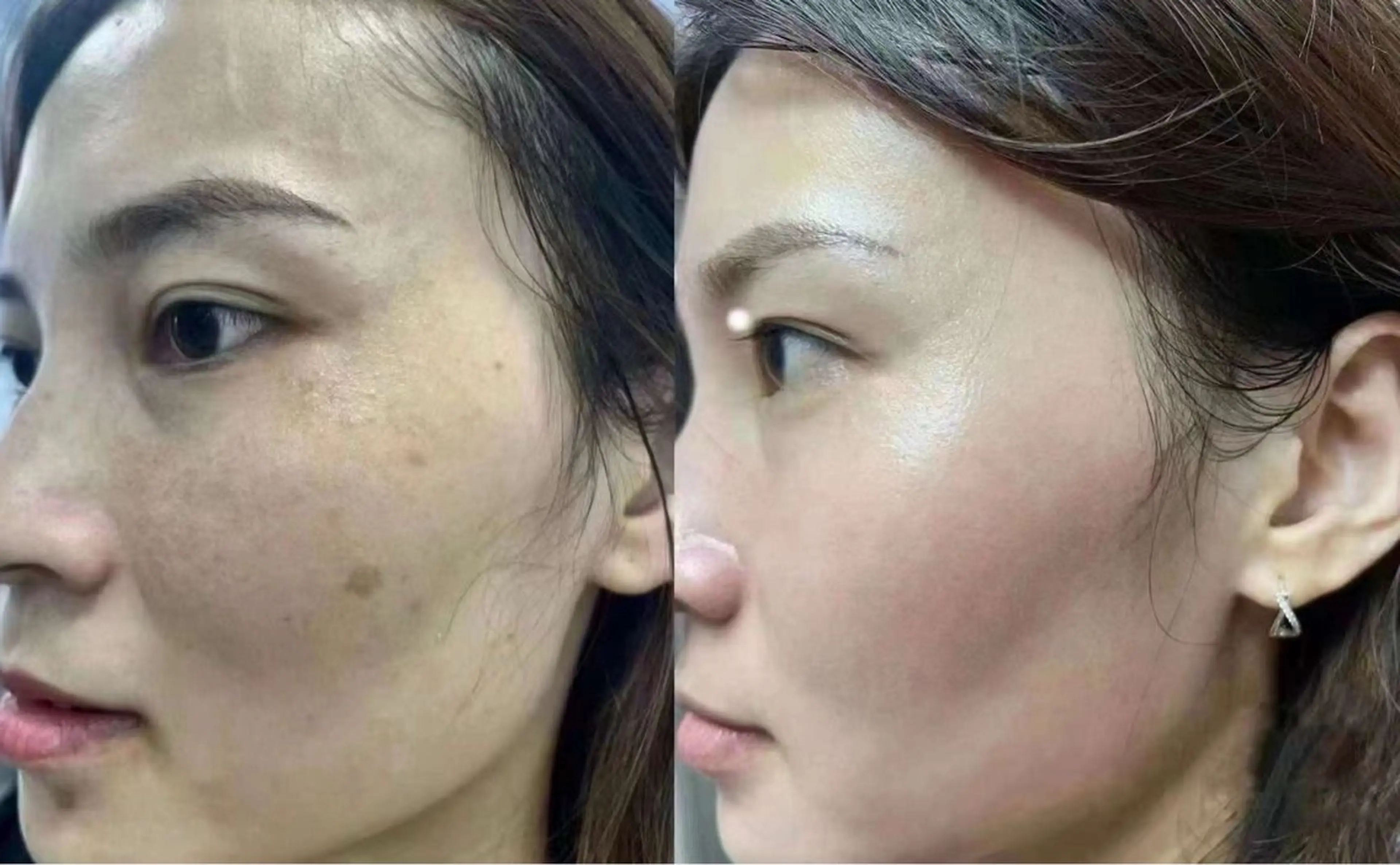 ネイル エステ aliaハイフ&水光ジェットサロン所属・aliaハーブ水光店 エステティシャン募集のエステ・リラクイメージ