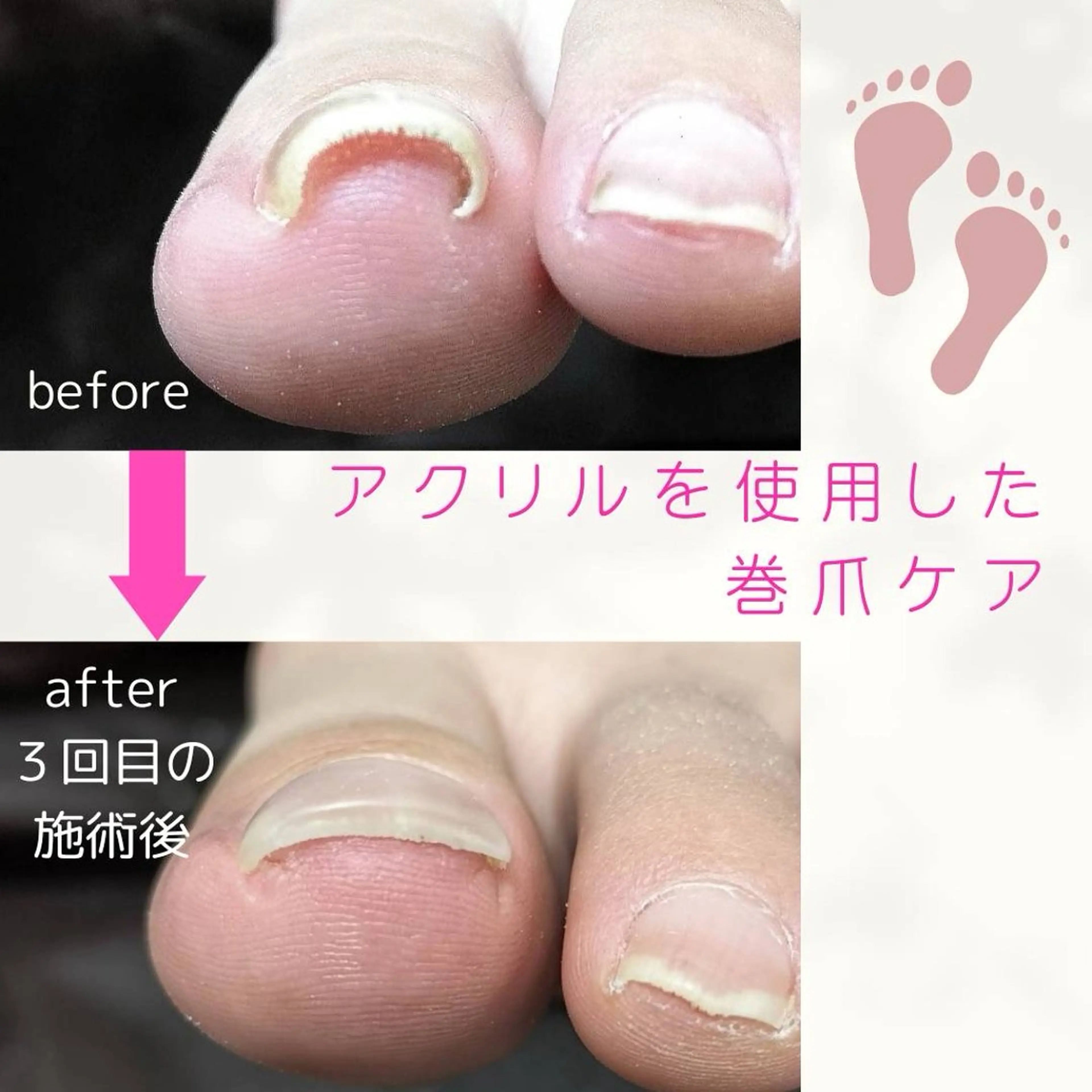 blanca🌺 mayu(東白楽)のマツエク・マツパデザイン