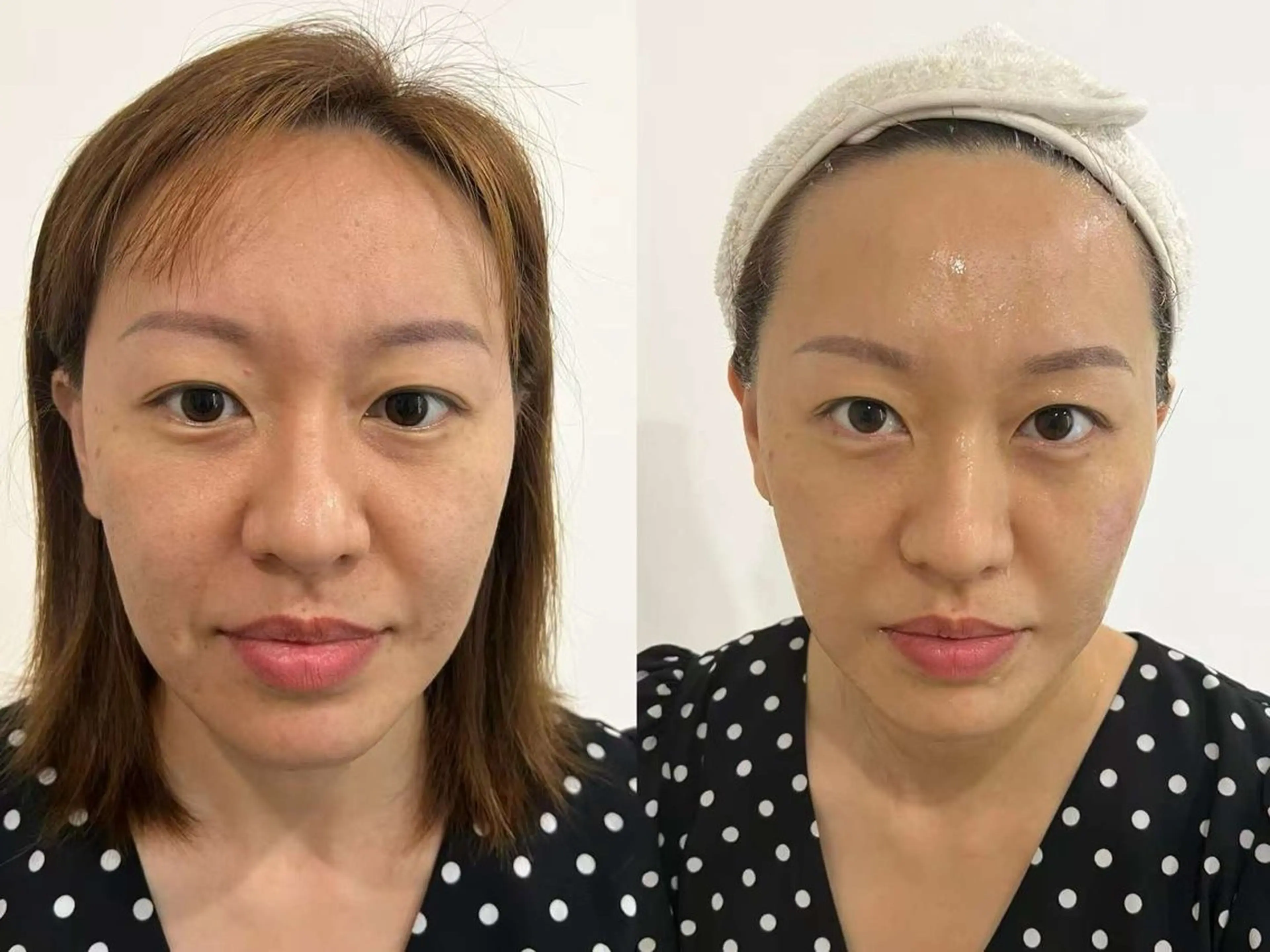 ネイル エステ aliaハイフ&水光ジェットサロン所属・aliaハーブ水光店 エステティシャン募集のエステ・リラクイメージ