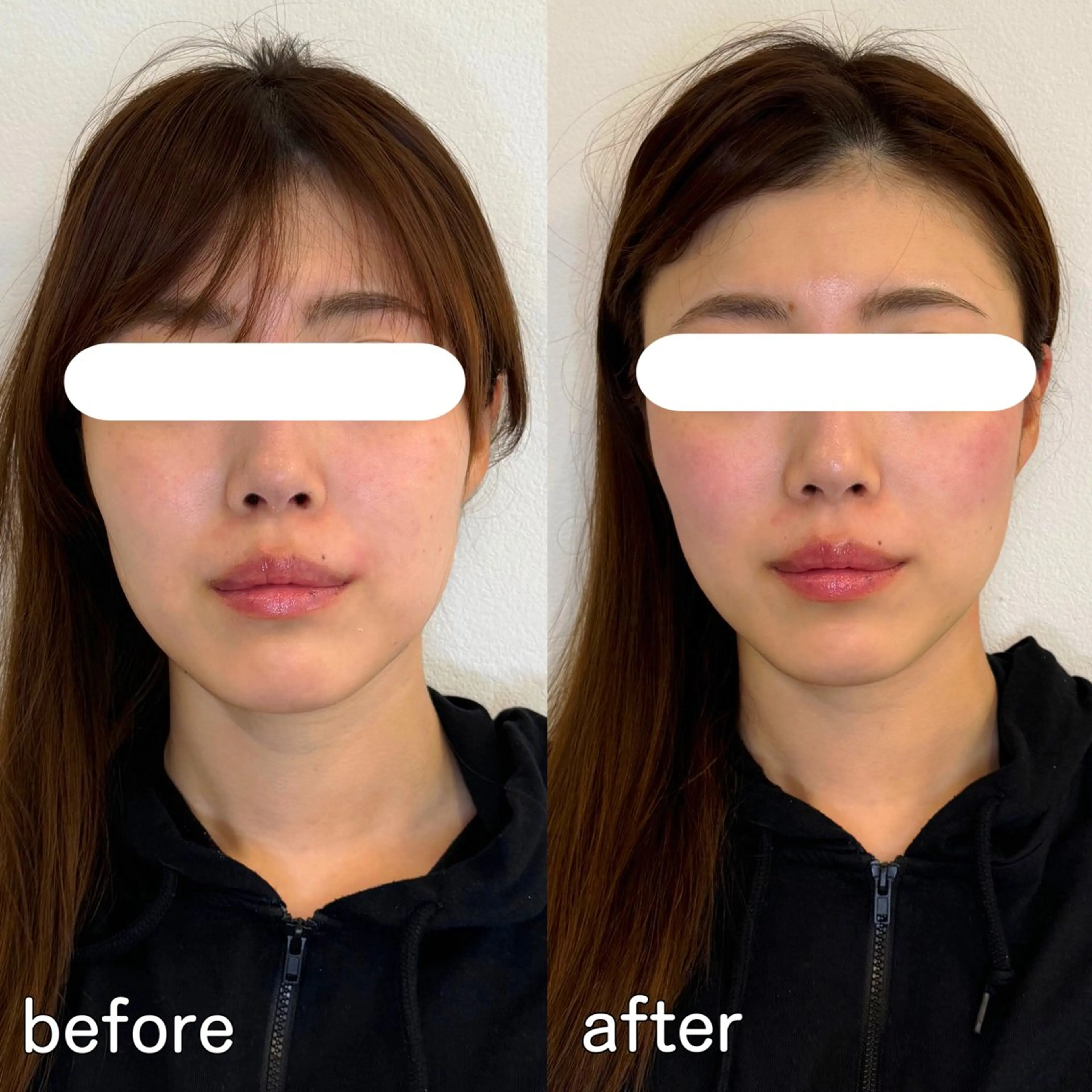 小顔矯正&美容整体 整え屋REDオーナーのエステ・リラクイメージ