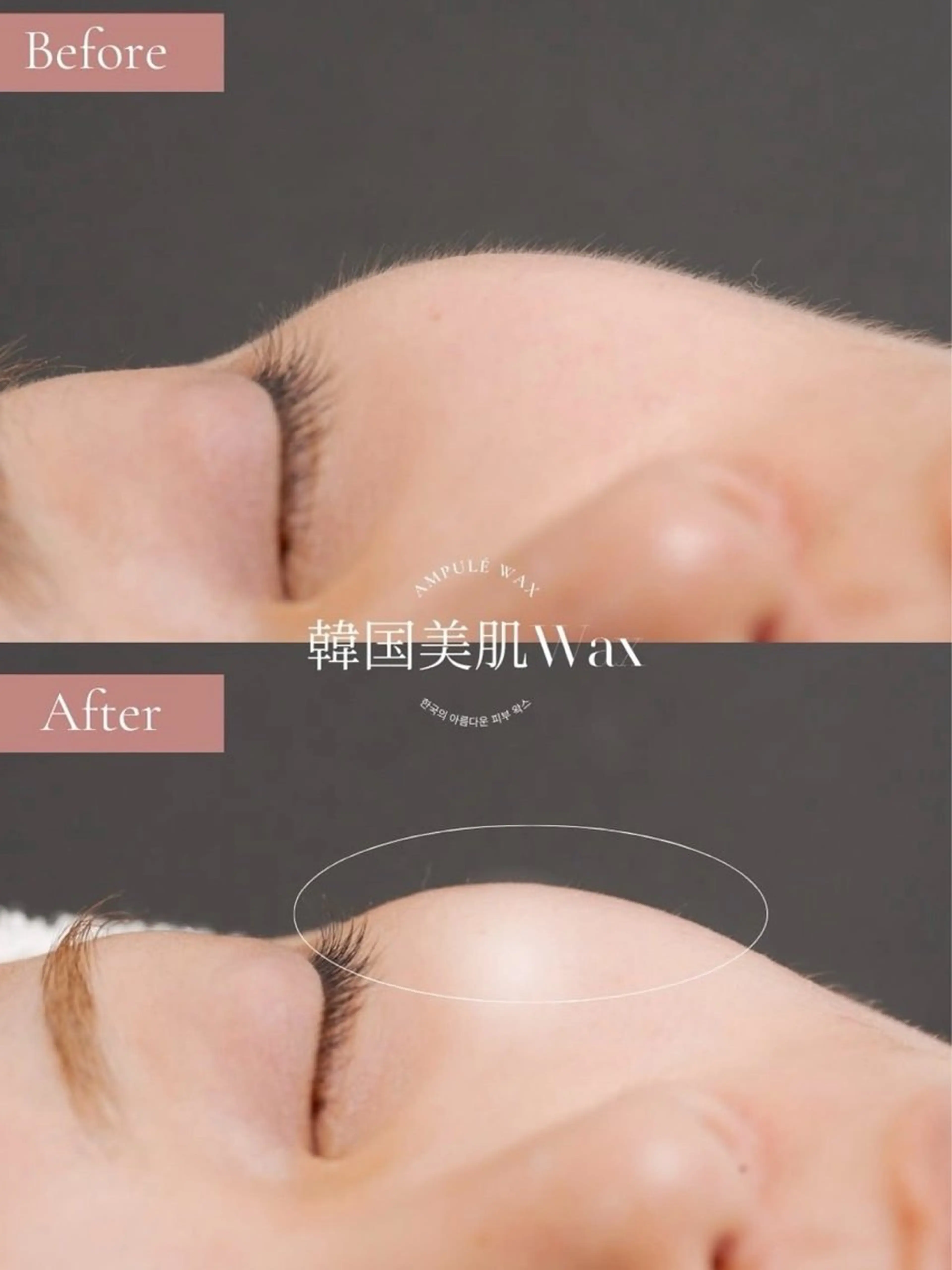 韓国艶玉🌟フェイシャルワックスします🌟産毛、角質を取り除き、トーンアップ💎透明感のあるお肌に💎の写真