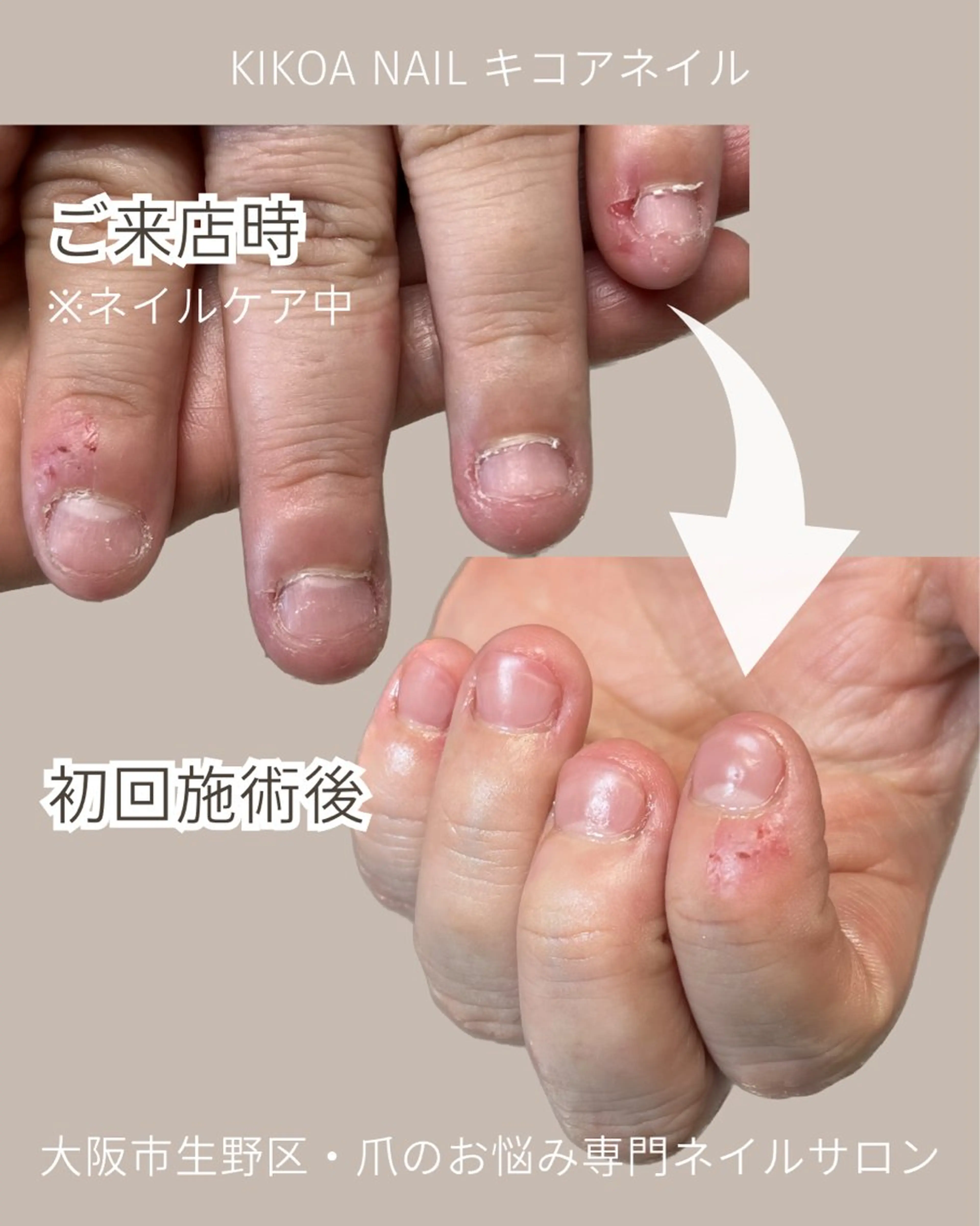 ネイル KIKOA NAIL キコアネイルのネイルデザイン