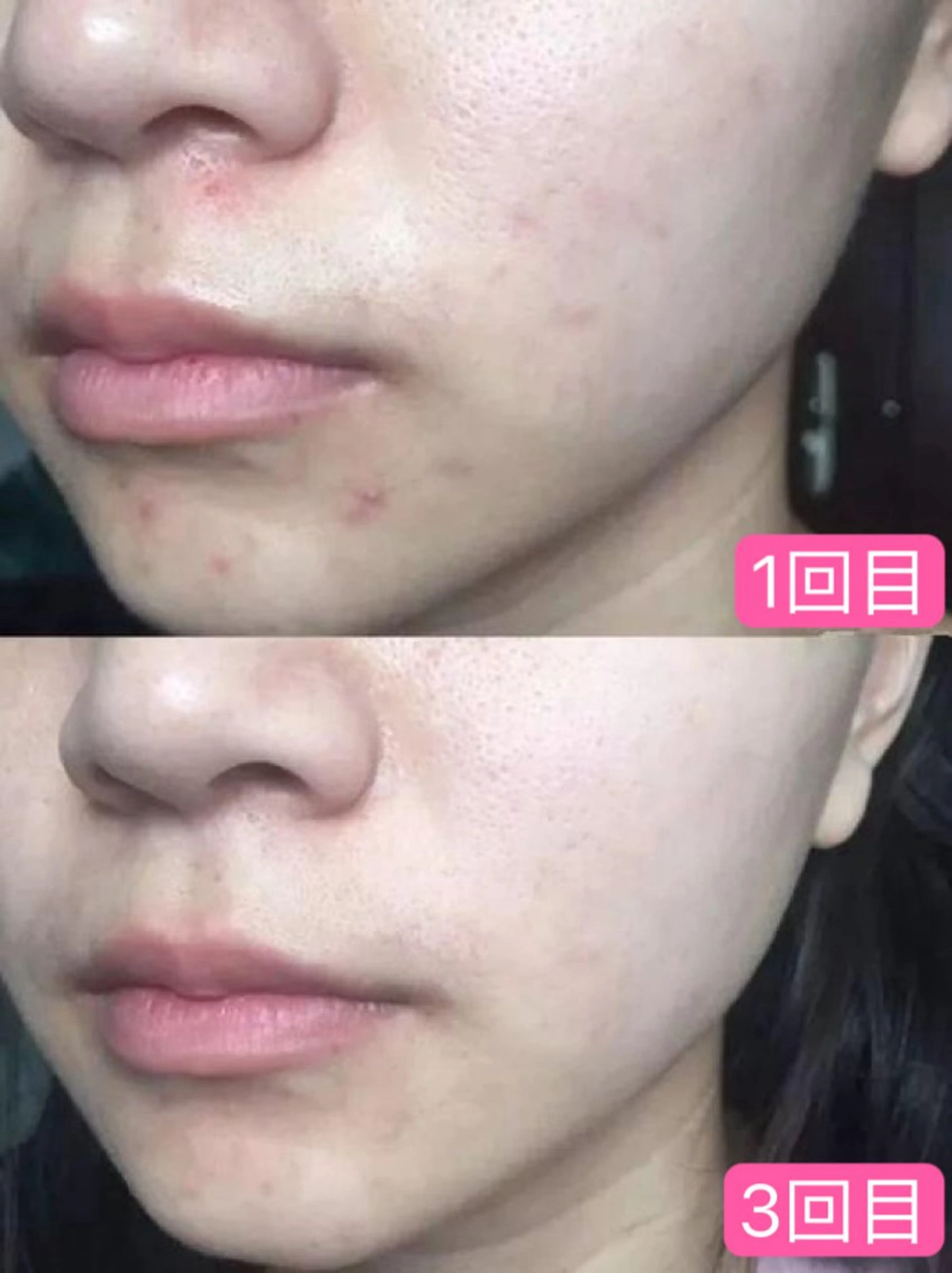 Nature Souce毛穴専門店のその他イメージ