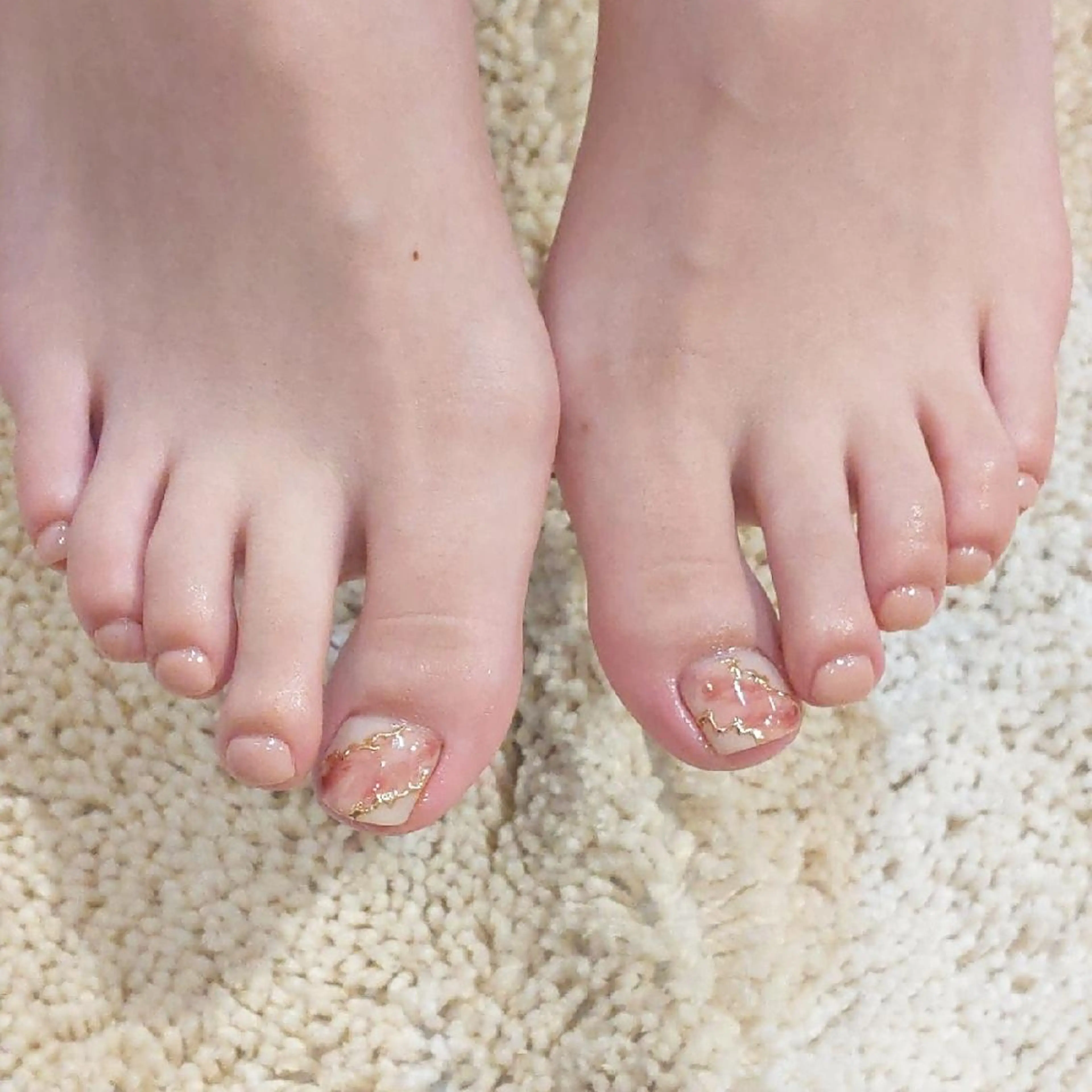 【🌼オフ込🌼】親指ワンポイント👣フットネイル💅+角質ケア🛀¥8060（🚋名駅/国際センター/ユニモール🚎）の写真