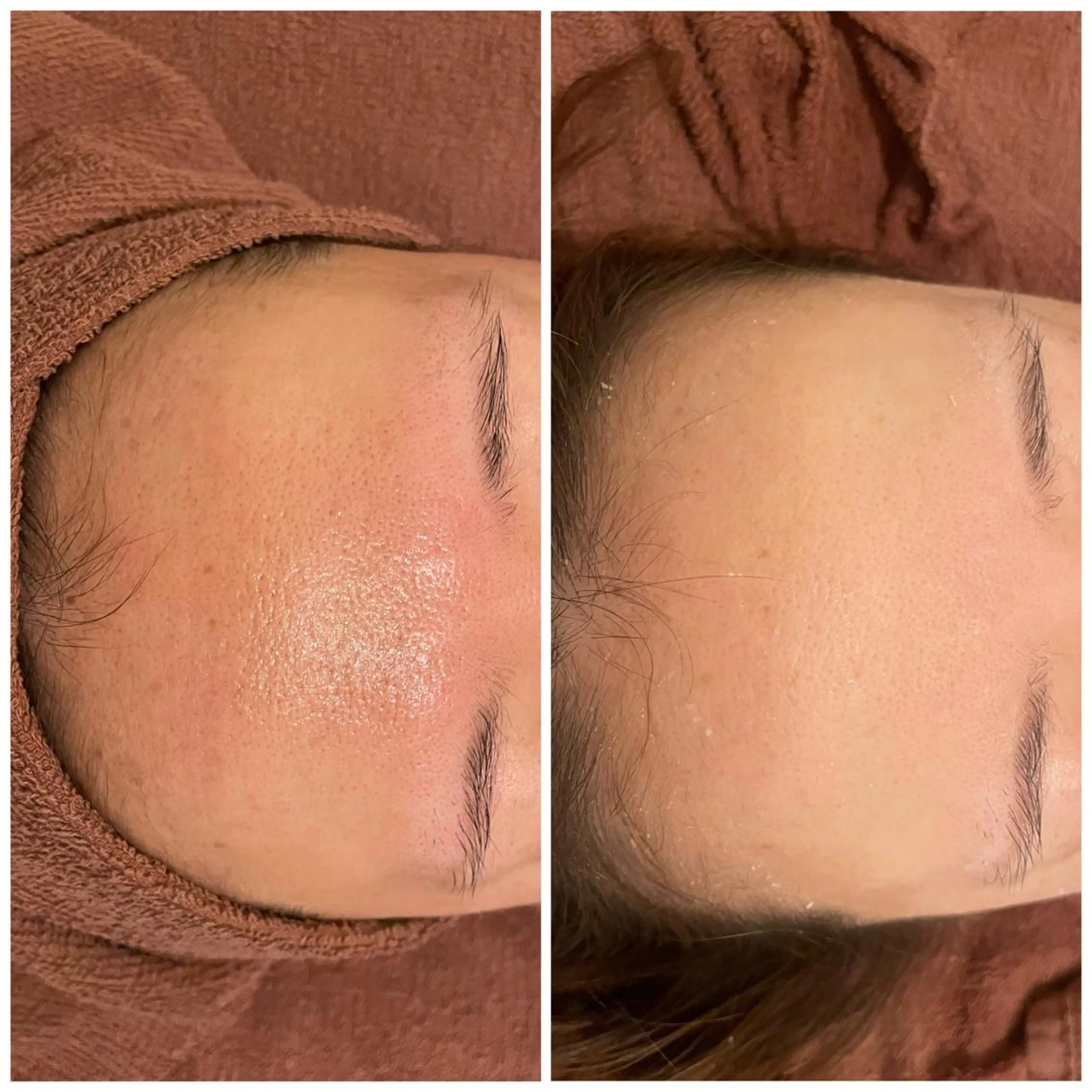 セミロング カラー パーマ ヘアアレンジ メンズ キッズ ネイル マツエク・マツパ アイブロウ ニキビ特化型エステ 🍓最短で肌質改善のエステ・リラクイメージ